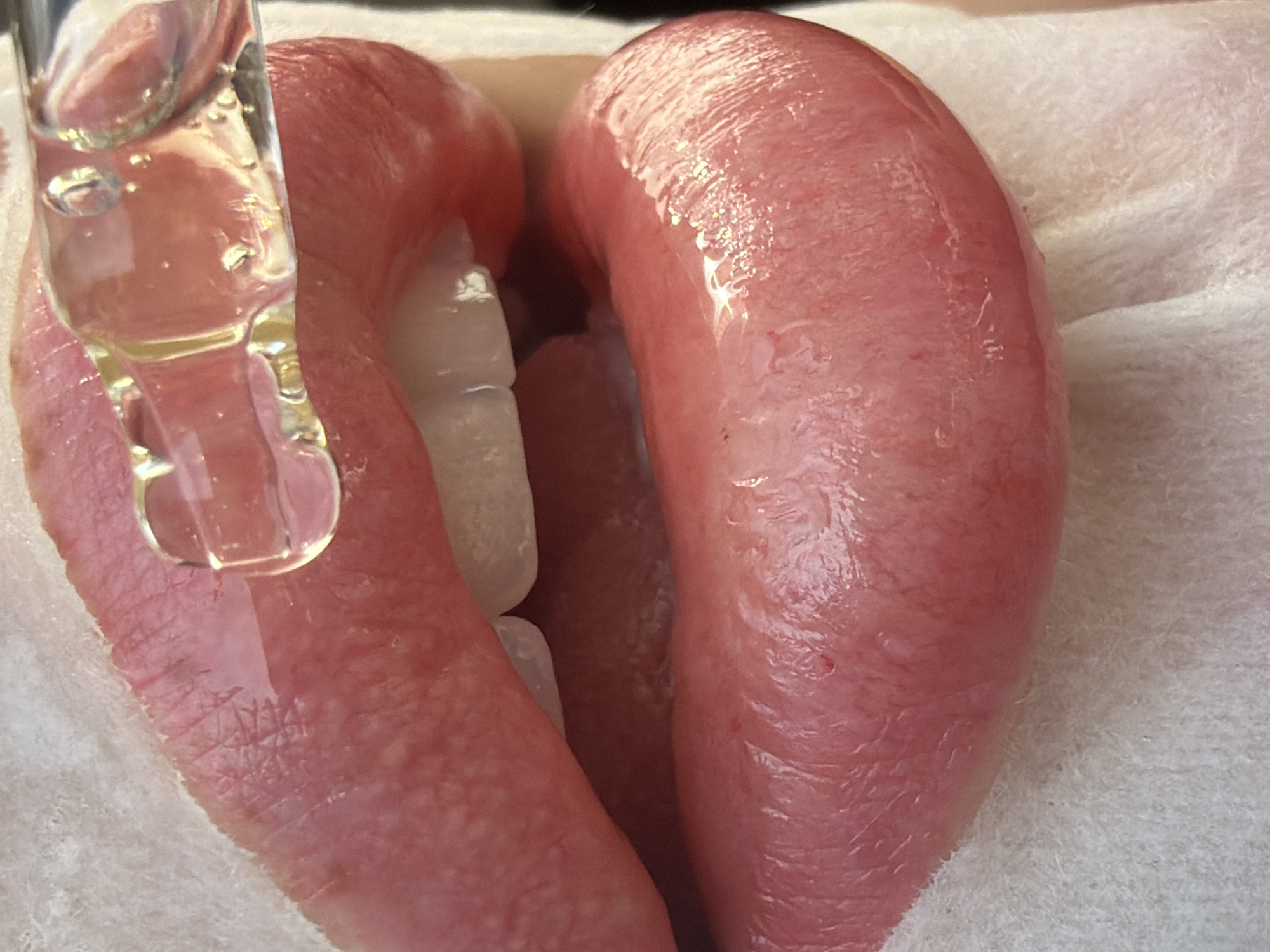 An extreme close-up shot reveals a person's lips, slightly parted to expose the upper teeth. A glass dropper, filled with a clear liquid, is positioned above the lower lip, appearing to apply the liquid. The lips are red, glossy, and textured, contrasting against the white teeth. The background is a blurred white fabric. The image does not contain information indicating its location or relation to Saint Petersburg, Russia.