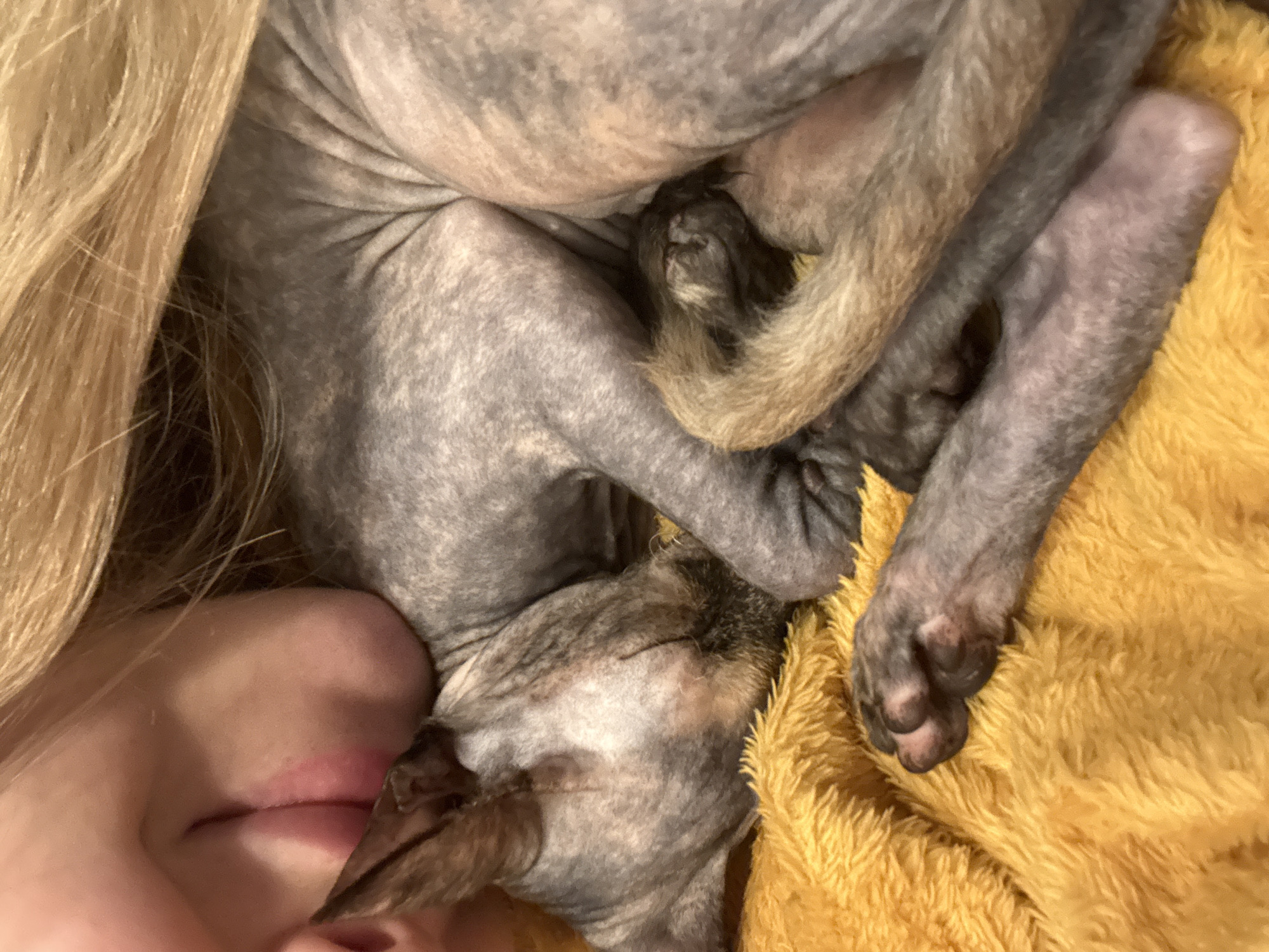 The image shows a close-up view of a hairless dog sleeping beside a person's face and blonde hair. The dog has gray and brown mottled skin. Its legs and curled tail are visible. The person's lips and part of their cheek are visible. A yellow, fluffy blanket is underneath the dog and the person. The location and city are unknown.