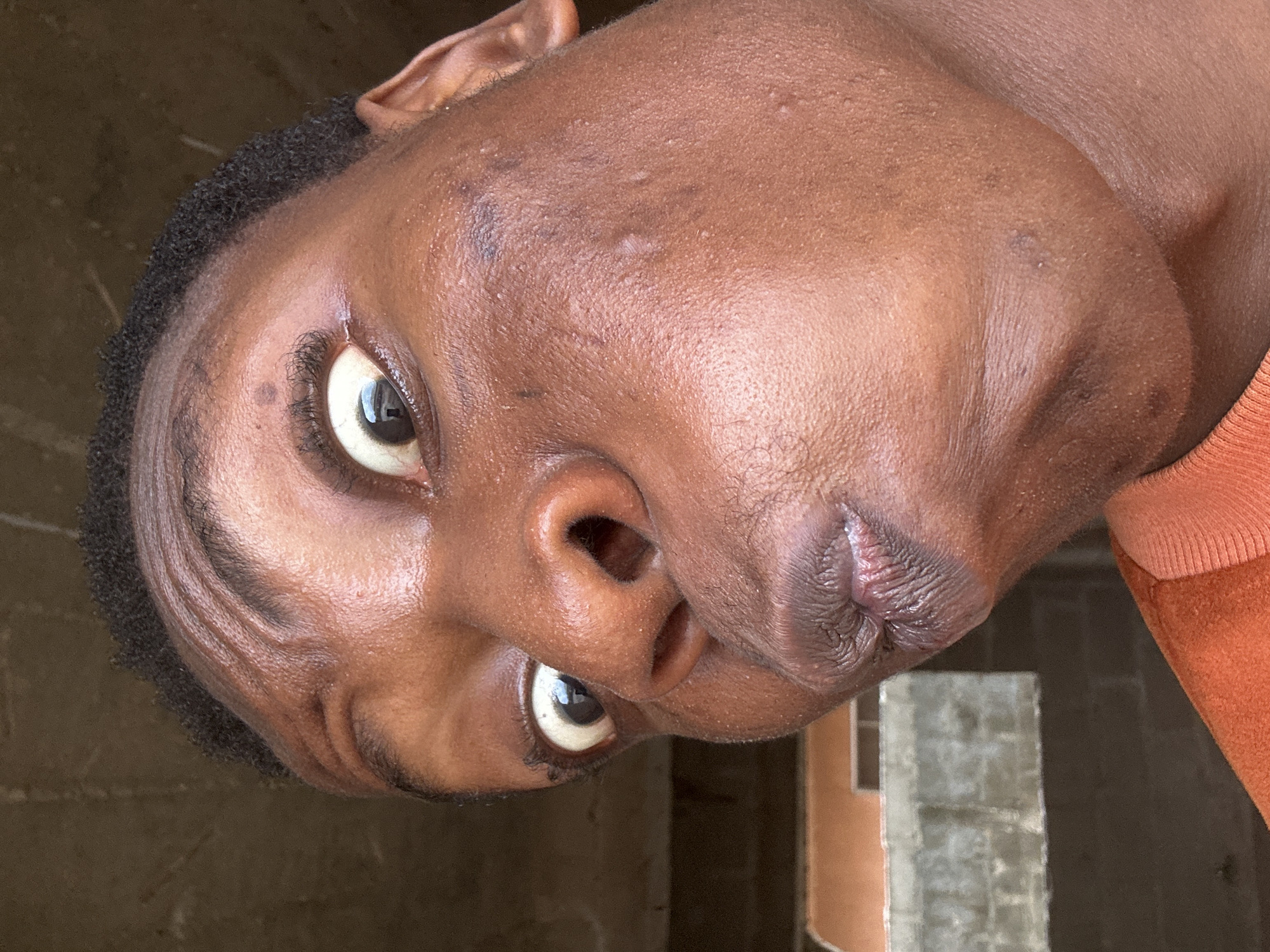 A close-up portrait shows an adult male with dark skin. His head is tilted to the left, with his eyes gazing directly at the camera. The man has short, dark hair and a slight furrow in his brow. The skin on his face is slightly shiny.
The background is blurred. To the right, a glimpse of an orange sweater and a grey concrete structure are visible.