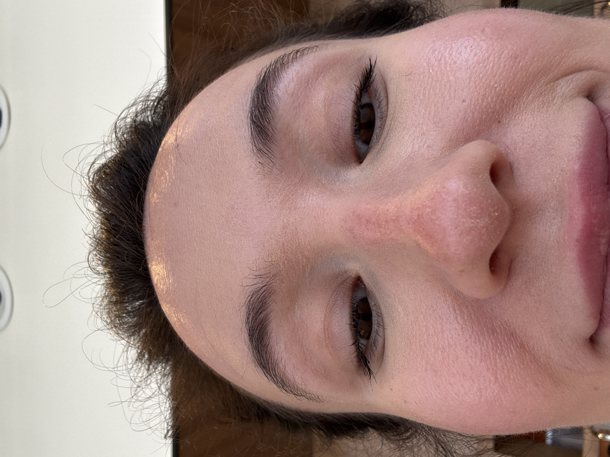 A close-up image of a person's face oriented at an angle. The person has fair skin, dark brown hair, and dark brown eyes. Their eyebrows are thick and well-defined. The nose appears slightly red and textured. Part of the lips are visible. The background is light and blurry, providing no specific details about location.