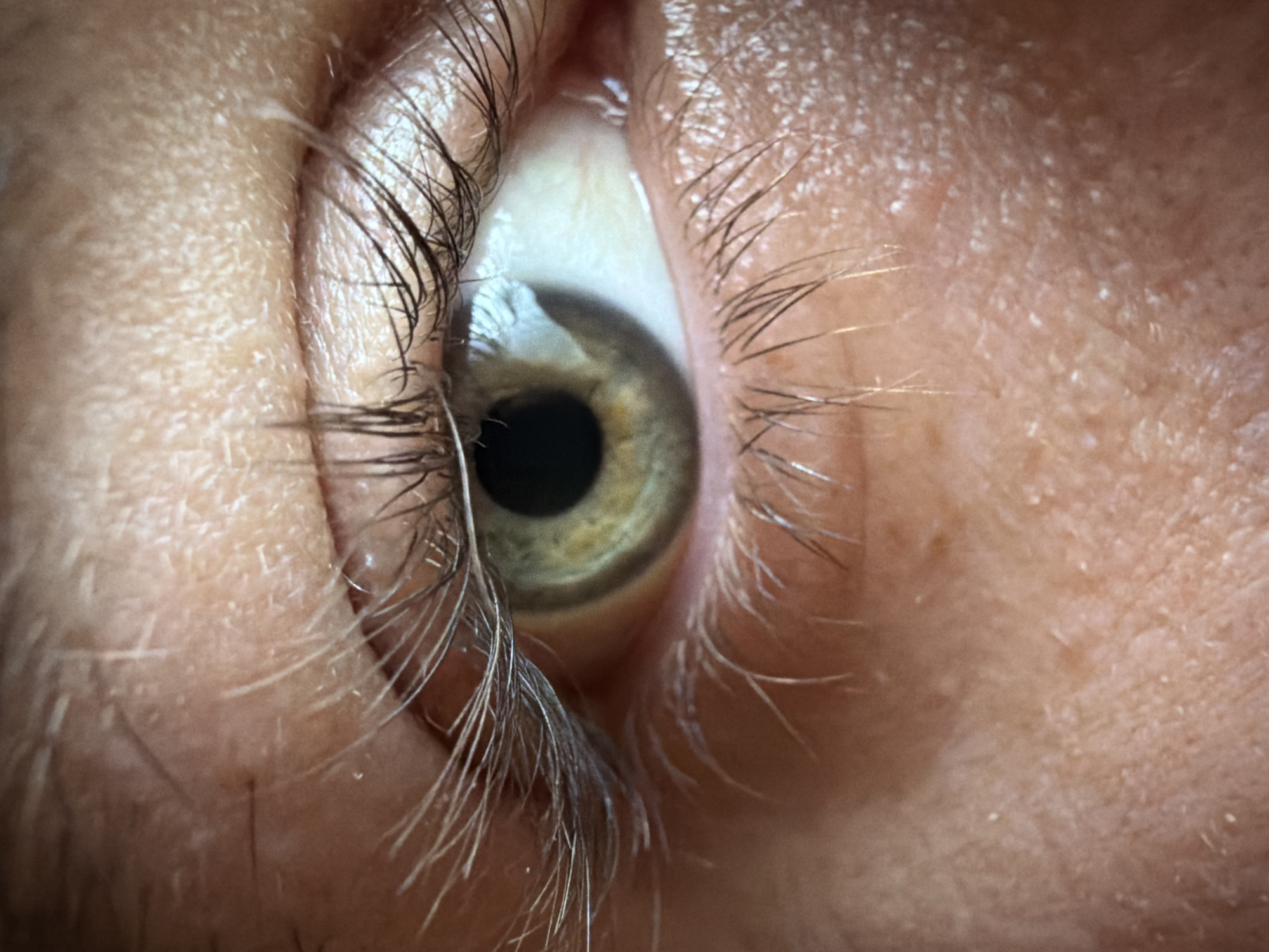 This is a close-up, macro photograph of a human eye. The eye is open, and the iris is a hazel color with flecks of green and yellow. The pupil is black and appears to be dilated. Eyelashes frame the eye, with both upper and lower lashes visible. The skin surrounding the eye shows texture, including fine lines and pores. The lighting suggests an indoor environment, possibly with artificial light creating reflections on the cornea. The image provides a detailed view of ocular anatomy. There is no indication of location in Sofia, Bulgaria, or any other specific geographic context.