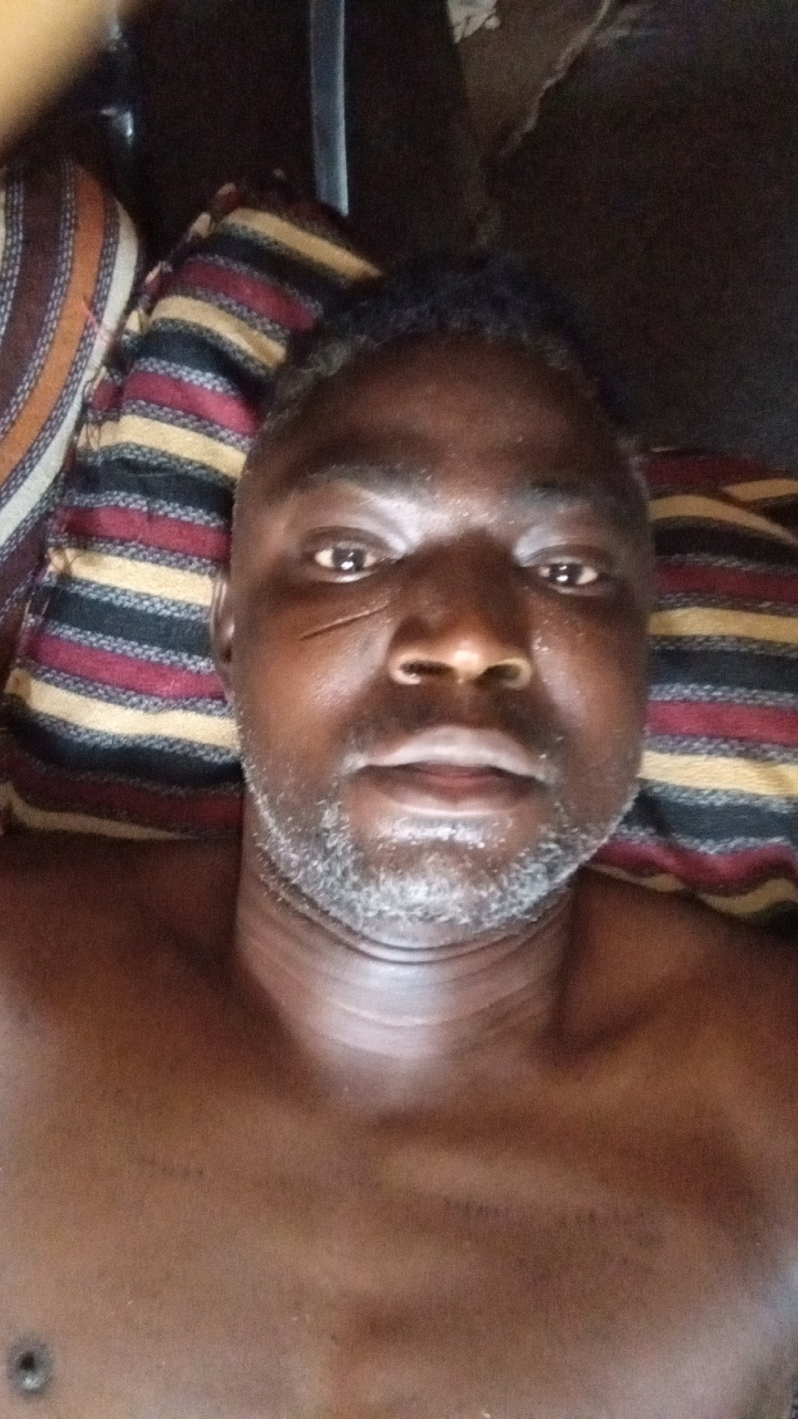A close-up selfie captures a dark-skinned adult man lying down, looking directly at the camera. He is shirtless, revealing his upper chest, and rests his head on a striped pillow with horizontal bands of red, black, yellow, and light brown. The man has short, dark, curly hair with visible grey strands, and a full beard that is significantly grey and white, especially around his chin and jawline.
A notable detail is the presence of two parallel, linear scars or tribal marks on his left cheek (viewer's right), running diagonally downwards from near his eye towards his nose. His expression is neutral and calm. The lighting in the image is somewhat dim, suggesting an indoor setting. The background is dark and indistinct, offering no further specific location cues. No text is visible.