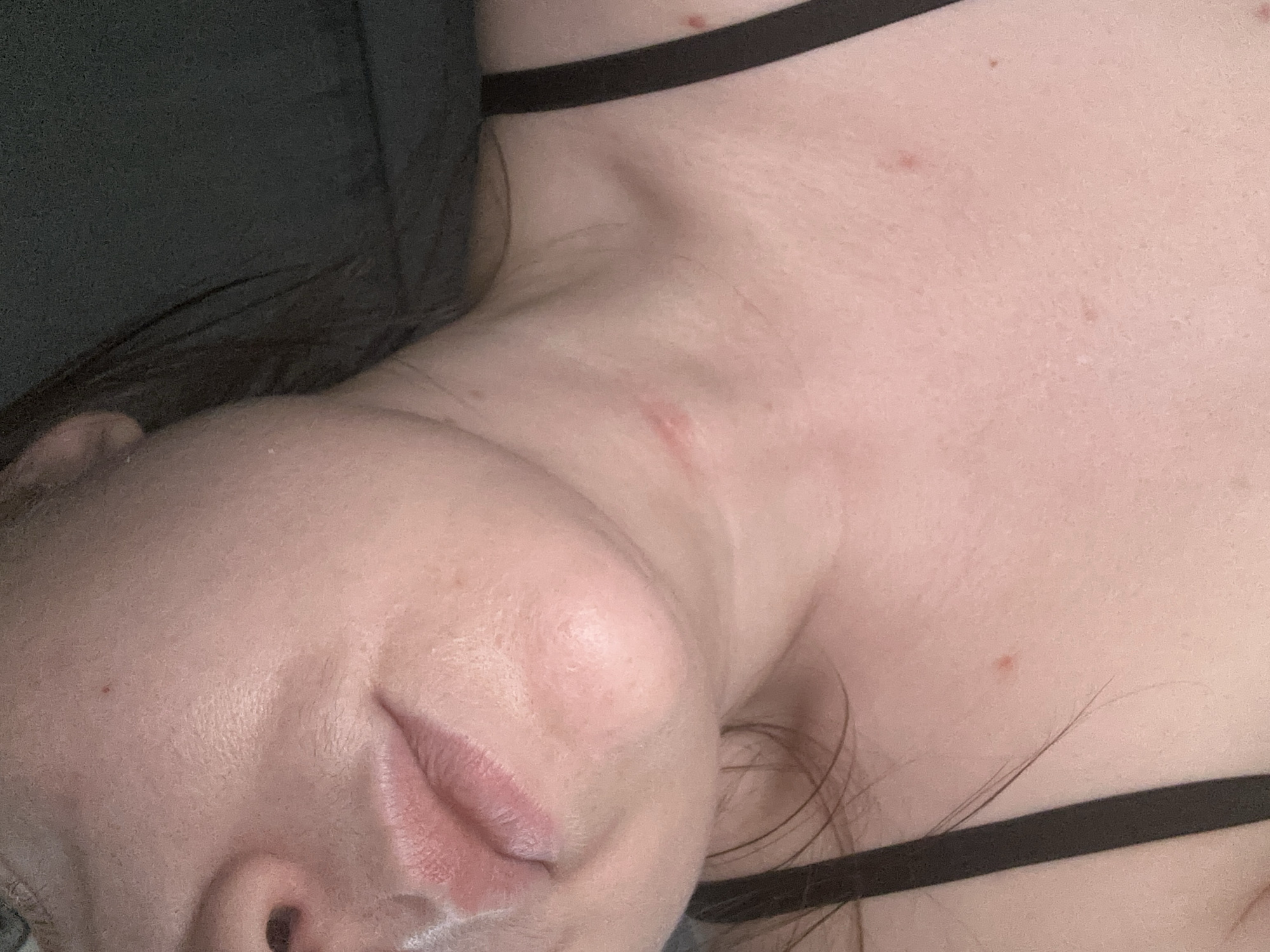 A close-up, angled view of a person's face, neck, and upper chest. The person appears to be lying down. The skin is light-toned with some blemishes or moles visible. They are wearing a black strap, possibly part of a garment, across their chest and neck. The background is a dark, indistinct color. The image provides no information about the city of Chaikovsky, Russia.