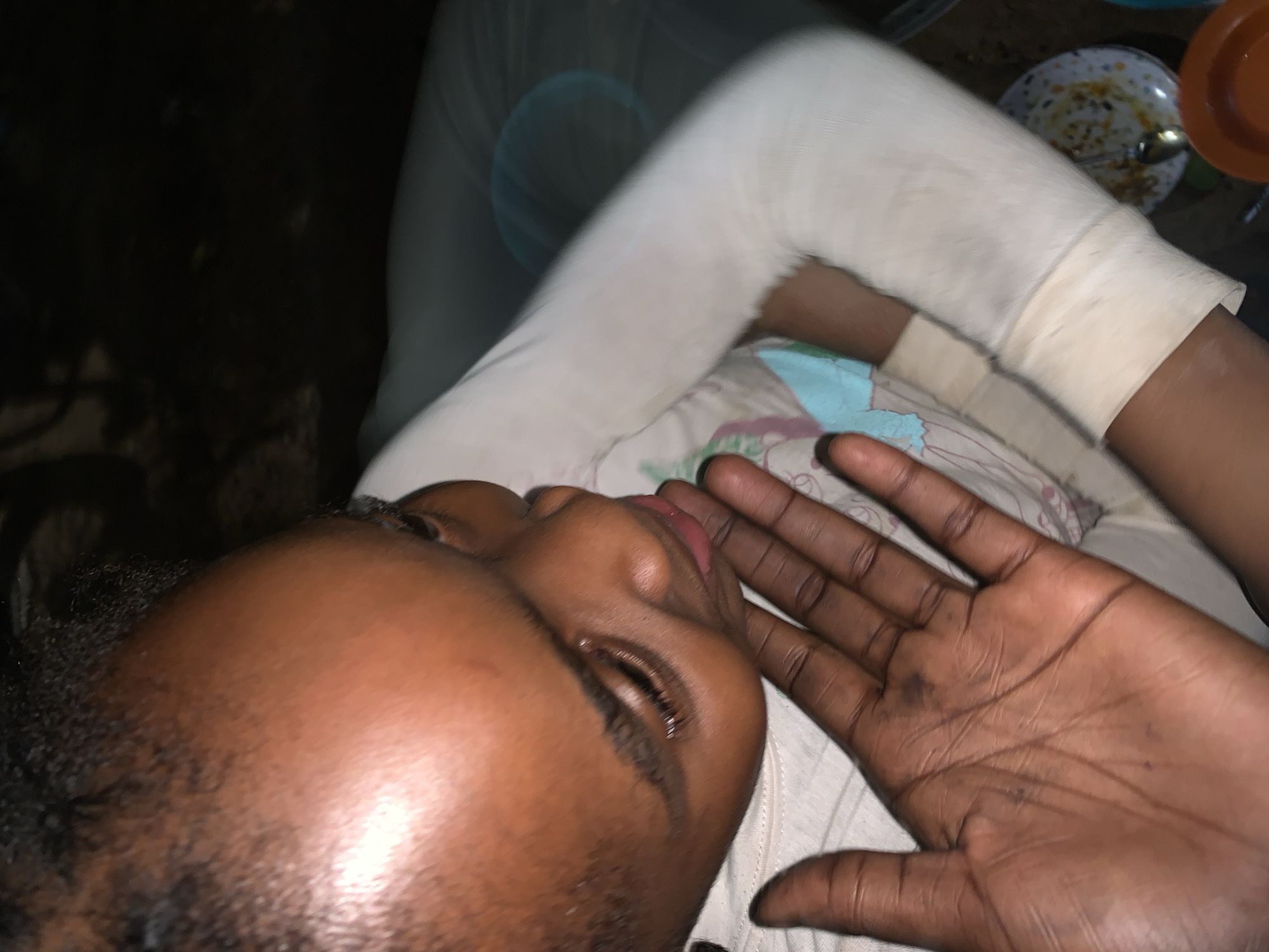 A close-up, low-angle shot shows a dark-skinned person lying down. The subject's left arm is in a white cast. The person's open hand is held up near their face. A plate and bowl are visible in the background. No information is provided to confirm that this image was taken in Jos, Nigeria.