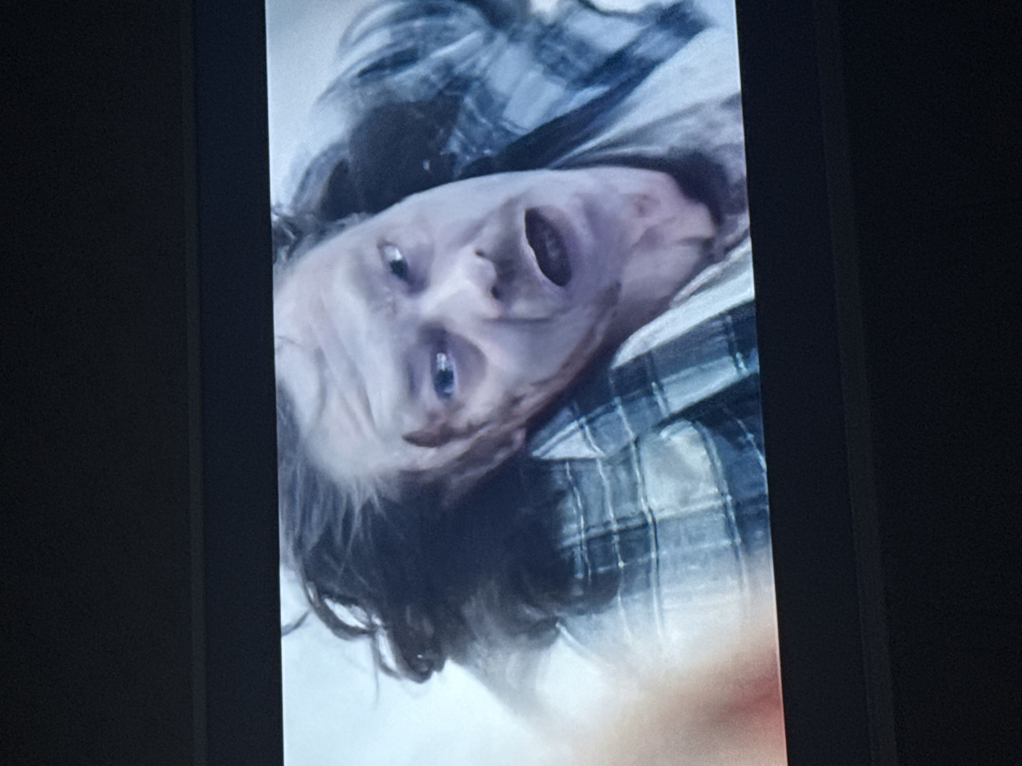 A person with a pallid complexion is lying supine, possibly deceased. The individual, wearing a plaid shirt, has dark hair and an open mouth. There is no information in the image to confirm or deny that this image was captured in Mytishchi, Russia. The image's lack of contextual information limits further analysis.