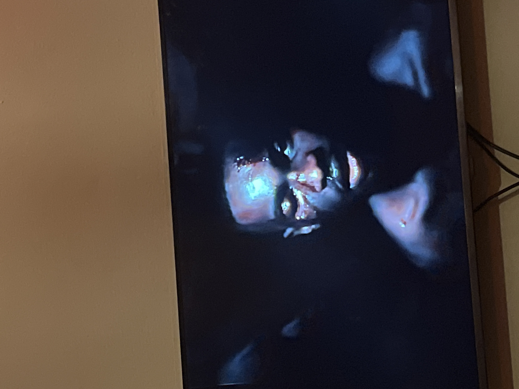 The image shows a close-up of a person's face, with apparent injuries. The person is looking directly at the camera. The background is dark and indistinct. There is no visible information about the location in the city of Gura Top, Nigeria.