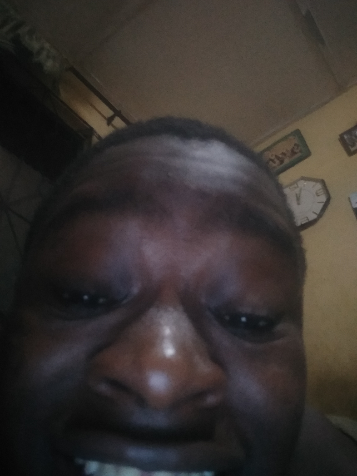 A close-up selfie of a dark-skinned person with a wrinkled forehead and squinting eyes. The nose is large, and the person is showing their teeth slightly. In the background, the ceiling is visible along with part of a wall with a clock and two framed pictures hanging on it. The location and city are unknown.