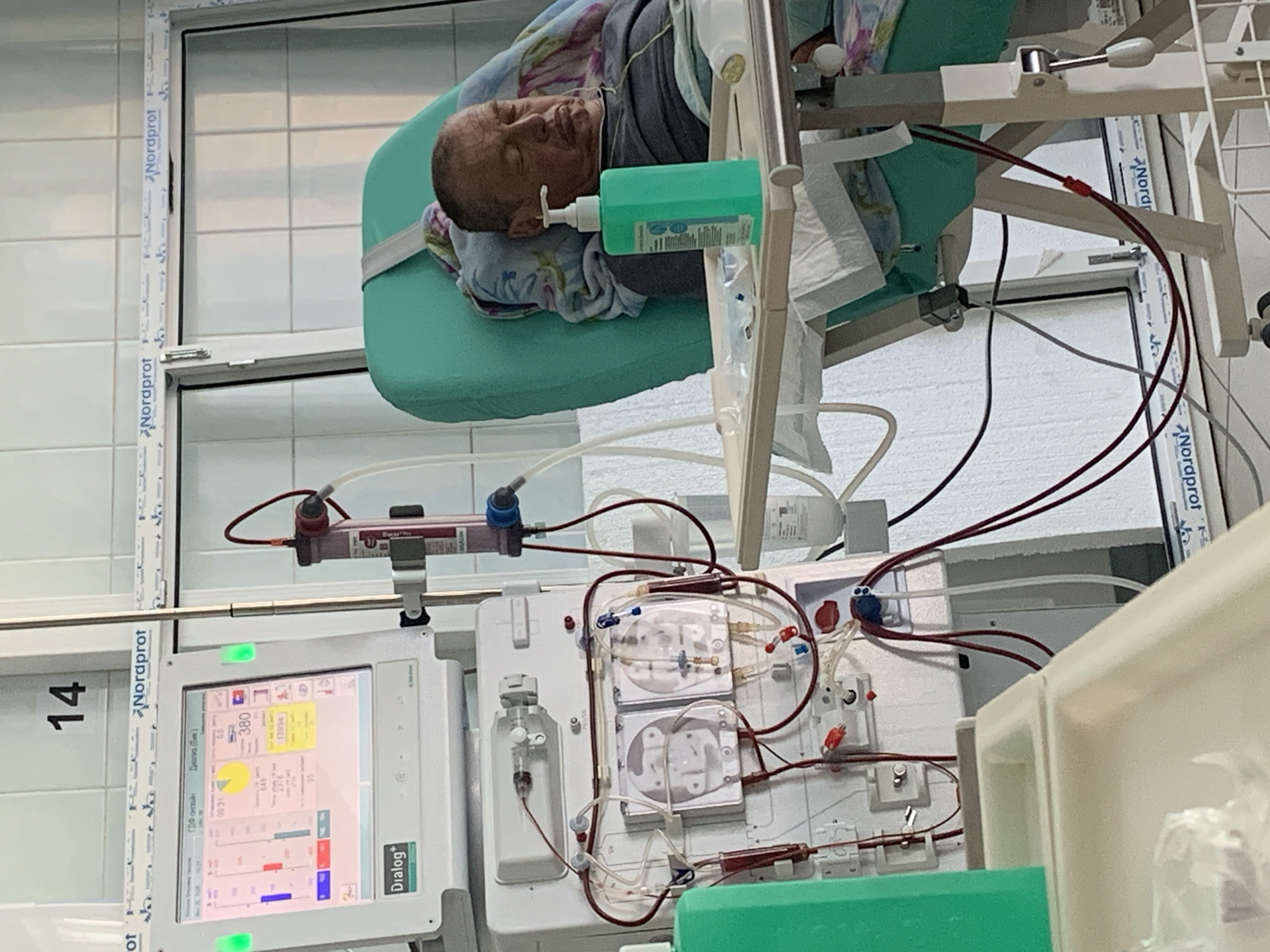 A middle-aged man is lying with his eyes closed in a teal recliner in what appears to be a medical setting. He is connected to medical equipment that includes a dialysis machine. The machine has a digital display showing various readings and is connected to the man via tubes and filters containing dark red fluid. A green bottle of hand sanitizer is placed on a tray beside the man. The room has tiled walls and a window with "Nordprot" branding visible. The man is wearing a grey shirt. A numbered sign indicating "14" is visible on the wall. The scene is forensic and matter-of-fact, describing the objects and the state of the individual.