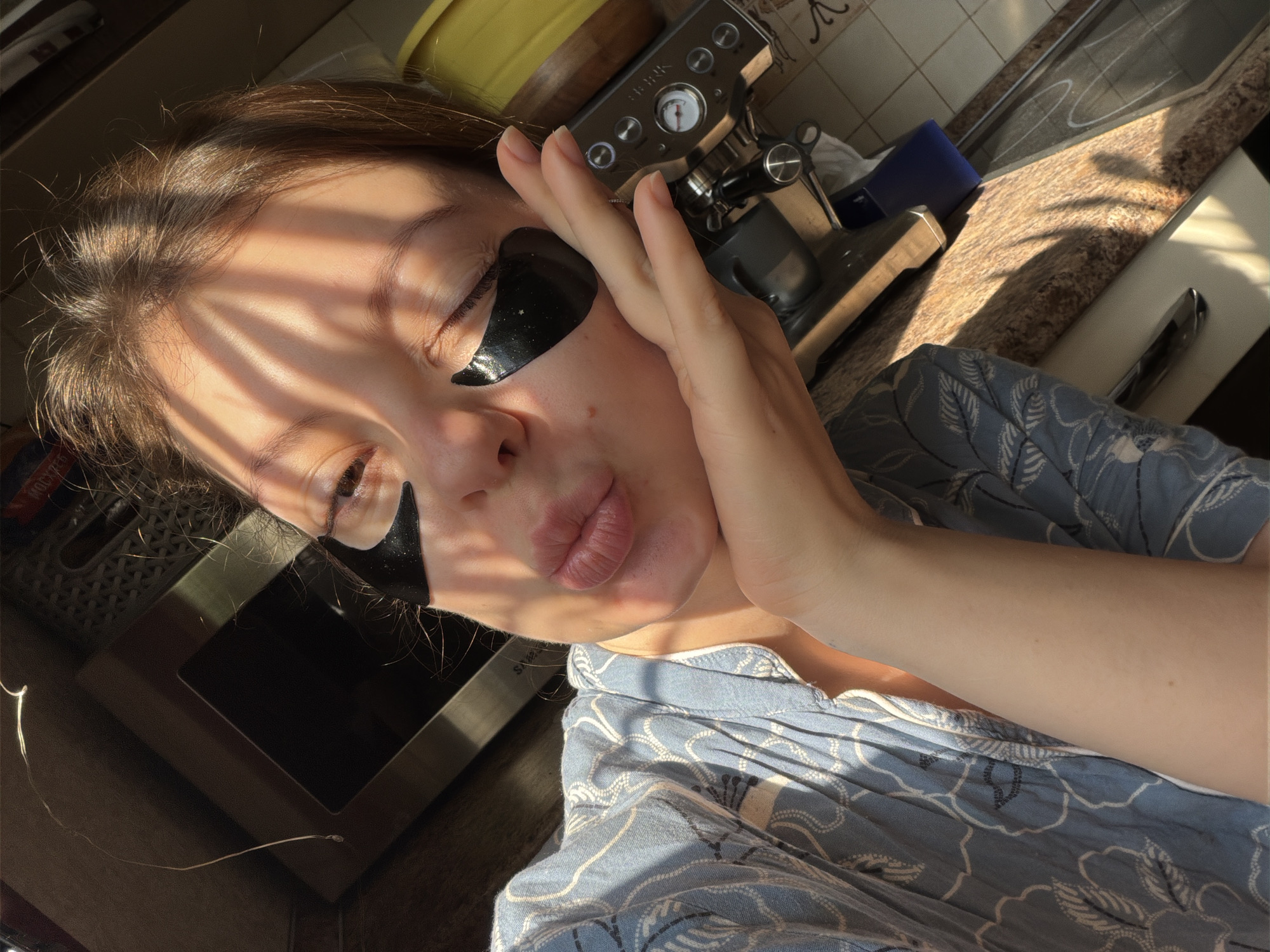 A person with dark hair is wearing black under-eye patches. The person is holding their hand to their face. Sunlight is creating shadows on the face. The person is wearing a blue patterned shirt. In the background, there is a countertop, an espresso machine, and other kitchen items. The image was taken indoors. There is no verifiable information to suggest the location is Khimki, Russia.
