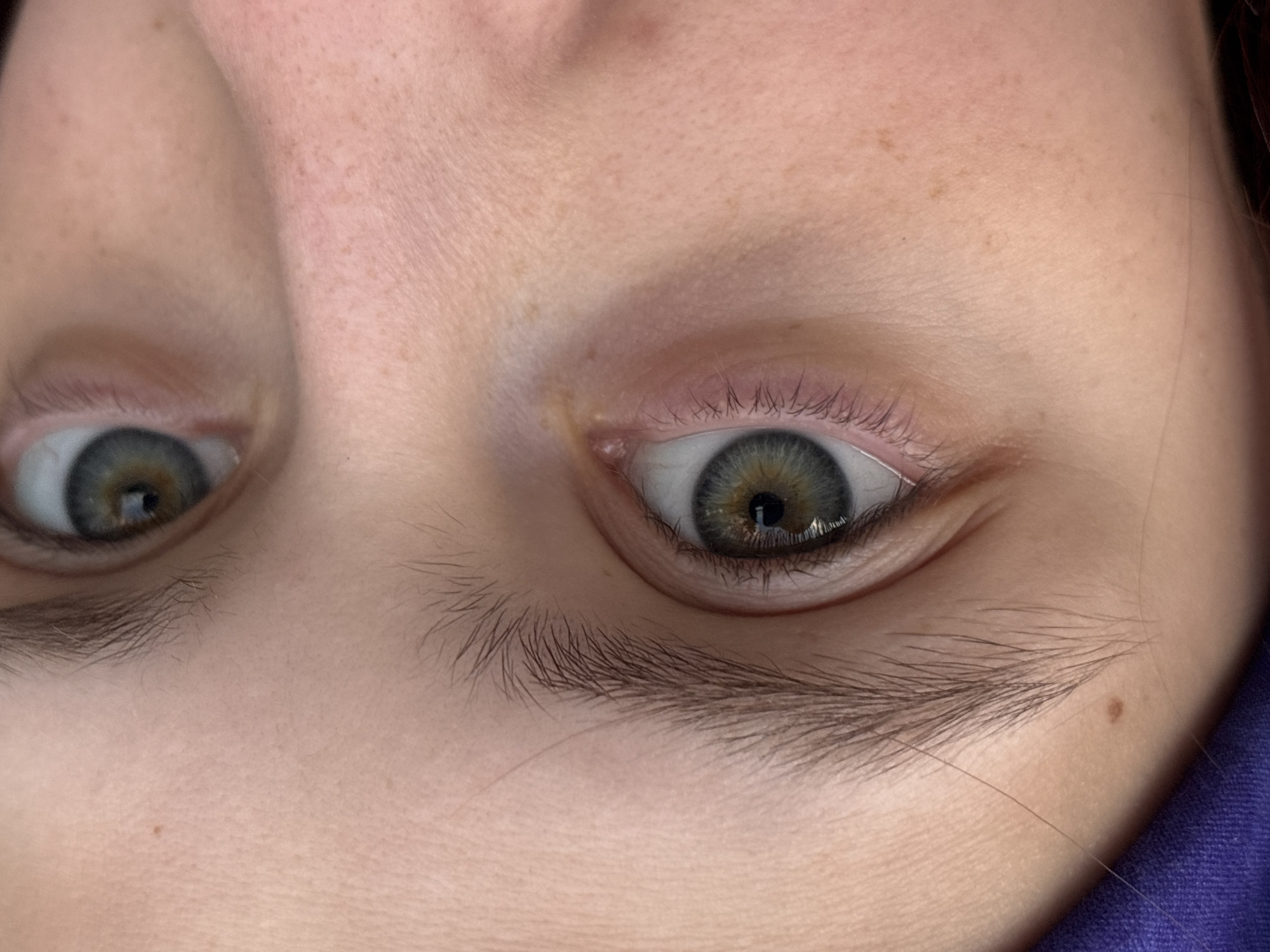 A close-up, slightly tilted view of a person's face, focusing on the eyes and surrounding skin. The person has light skin with freckles visible on the forehead and cheek. The eyes are a mix of grey, green, and brown hues. The eyebrows are thick and dark. The image captures the upper portion of the face, with a hint of purple fabric visible at the lower right, suggesting clothing. The setting and city are indiscernible from the provided image.
