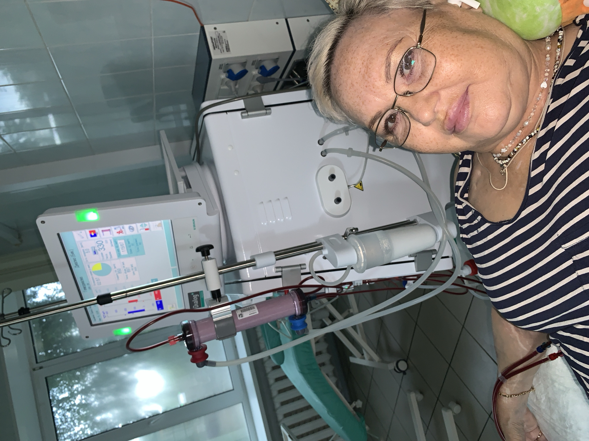 This is a medium shot, eye-level photograph taken indoors, likely in a medical facility. A middle-aged Caucasian woman with short, graying blonde hair and wearing glasses is positioned in the foreground, reclining and looking towards the camera with a neutral expression. She is wearing a navy and white striped shirt and several necklaces. Her left arm is visible, with a medical tube attached.
Behind the woman is a dialysis machine, a complex piece of medical equipment with a white body, a screen displaying medical data, and numerous tubes and connections. A stand holding an IV bag is attached to the machine. In the background, a green medical chair on wheels is visible, along with tiled walls and a large window showing trees and overcast sky. The overall impression is that of a dialysis treatment in progress within a hospital or clinic setting. There is no explicit indication of the city of Chaikovsky, Russia within the image itself.