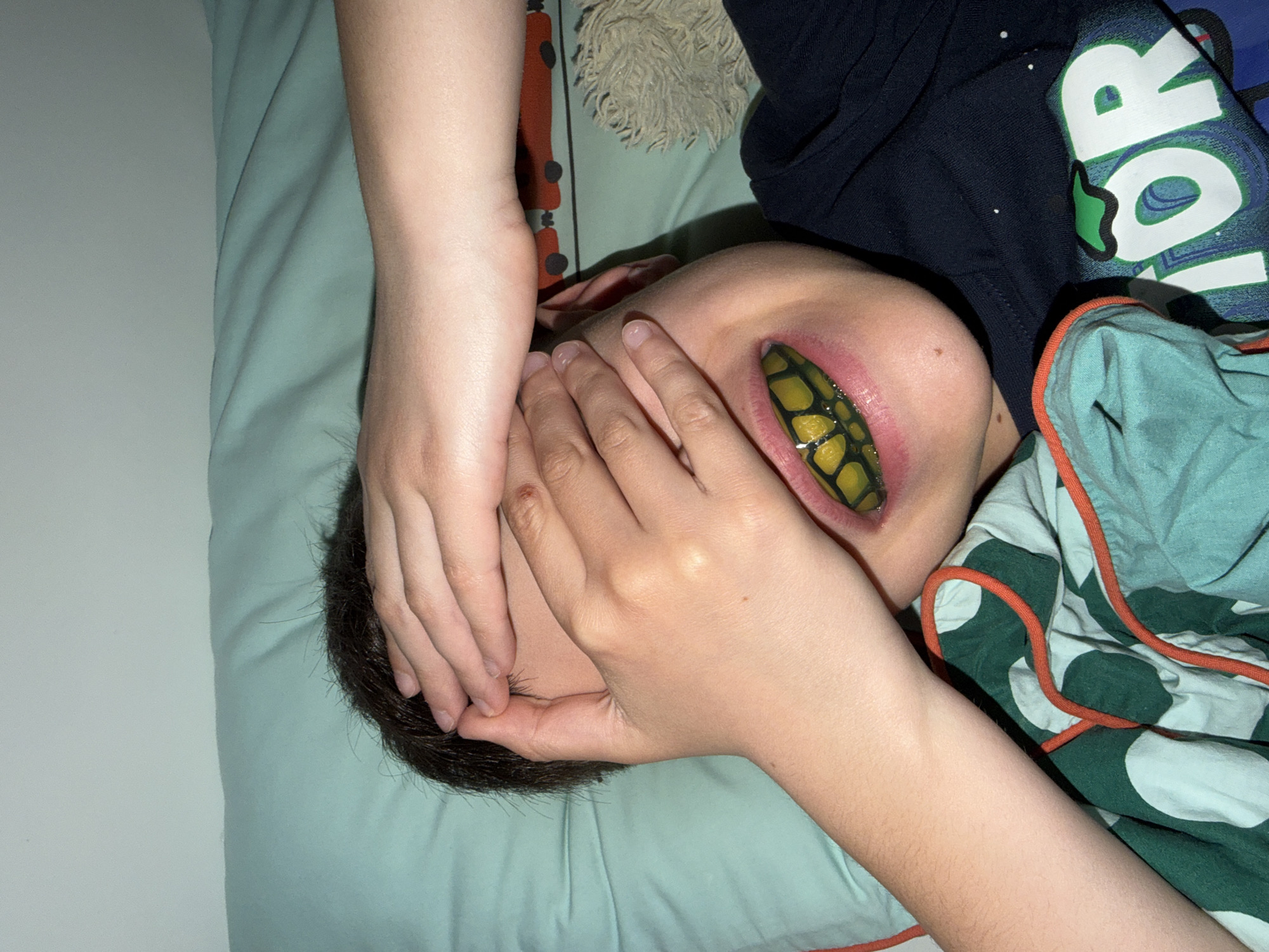 The image shows a person lying down with their face partially obscured by their hands. A yellow and black snake-like object is placed in the person's mouth, causing their lips to be stretched. The person is wearing a dark blue shirt and lying on a bed with a light blue sheet. There is a green and white patterned blanket with orange trim partially visible. The background includes a white wall. There is no indication that the image was taken in Votkinsk, Russia.