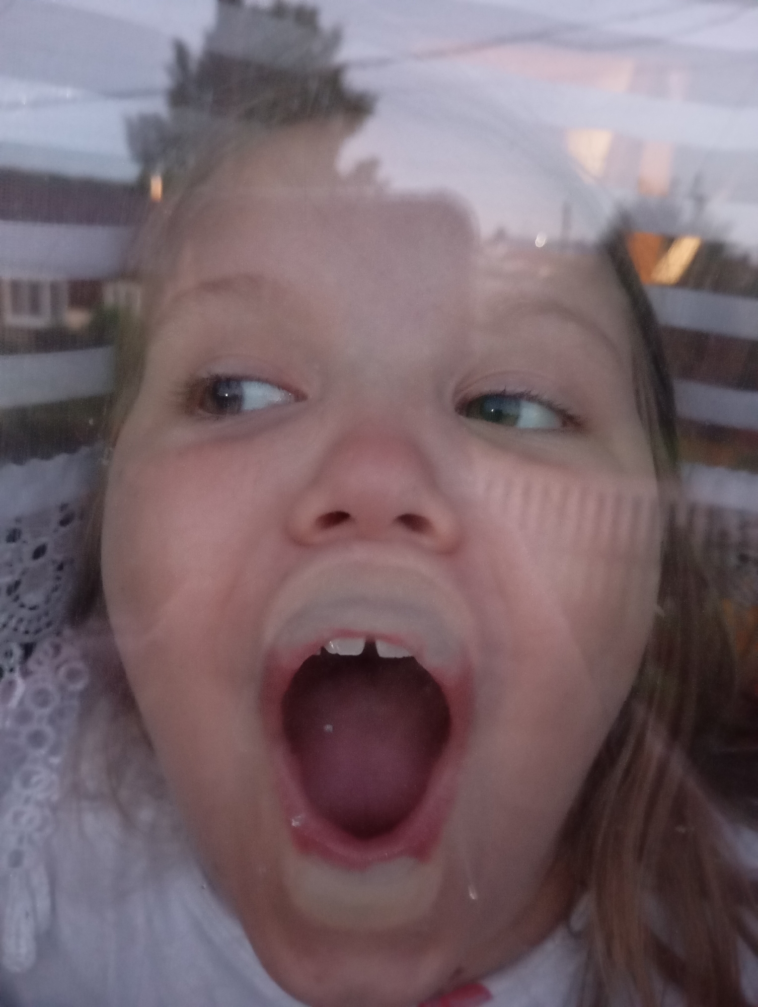 A close-up, slightly distorted, low-angle shot shows a young girl with her mouth wide open as if screaming or yawning. She has light brown hair and two visible front teeth. Her eyes are looking to her left and right respectively, with one appearing to be brown and the other greenish. There are faint horizontal lines impressed on her cheek, likely from something she was leaning against. The background is blurred and reflects an outdoor scene with a building and trees, suggesting it might be daytime. The overall mood is one of surprise or exuberance. The location context is "Foki, Russia".