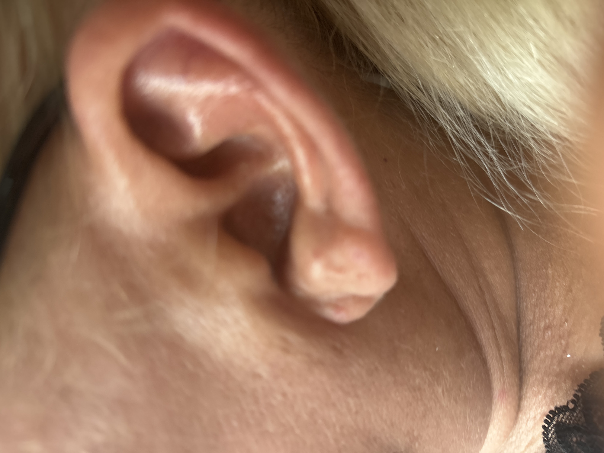 The image shows a close-up, slightly out-of-focus view of a human ear and the side of a neck. The skin is fair-skinned, and the ear is a pale pink color with visible folds and contours. Some blonde hair is visible to the right of the ear and neck. The neck area shows some subtle wrinkles and pores. The lighting appears to be natural, casting soft highlights on the skin and hair. There are no discernible objects or actions occurring in the scene beyond the depiction of the person's anatomy. The location is not specified as being in a city.