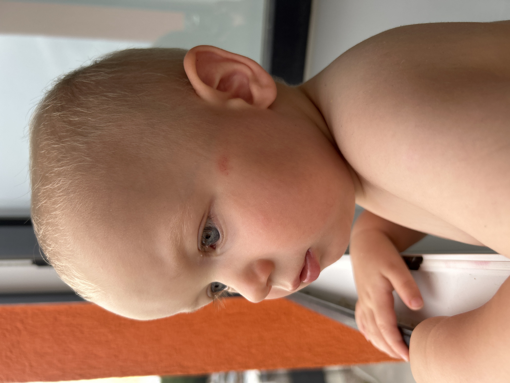 The image is a close-up profile of a fair-skinned, blonde toddler boy. He is looking to the left of the frame with blue eyes and rosy cheeks. A small red mark is visible on his left cheek. His right ear is prominent. He is shirtless, and his left arm is visible, resting on a white railing or frame. To the left of the boy, an orange wall is visible. The background appears to be outdoors, with some blurry shapes that could be part of a building or foliage. The image is a medium shot, focusing on the child's head and upper body. The photograph appears to have been taken during daylight. The location in the city of Kaluga, Russia, is not discernible from the visual information provided.
