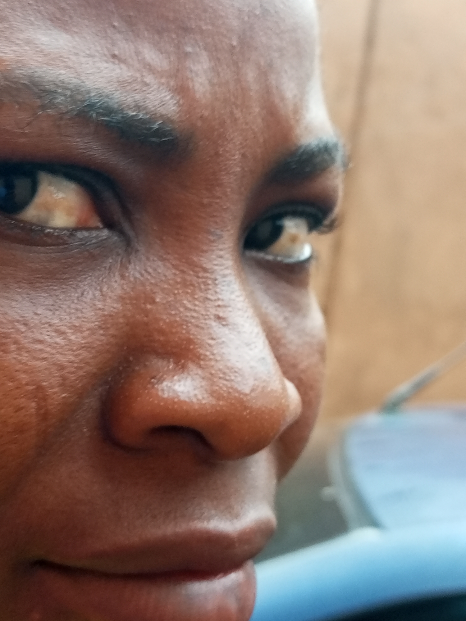 The image is a close-up, low-angle shot of the face of a person with dark skin, viewed from the side. The focus is on the right eye, eyebrow, nose, and mouth. The skin shows texture and some imperfections. The person's eye is open, and they appear to be looking slightly upwards and to the left. Some eyelashes are visible on the upper eyelid. The eyebrow is dark and shaped. The nose is prominent, with nostrils visible. The lips are slightly parted, revealing the lower lip and a hint of teeth. The background is blurred and appears to be an outdoor setting with a light brown wall or structure on the right and a blue object, possibly part of a vehicle, in the lower right portion of the frame. The lighting suggests it is daytime. The specific location in Tempure, Nigeria, cannot be determined from the visual information provided.