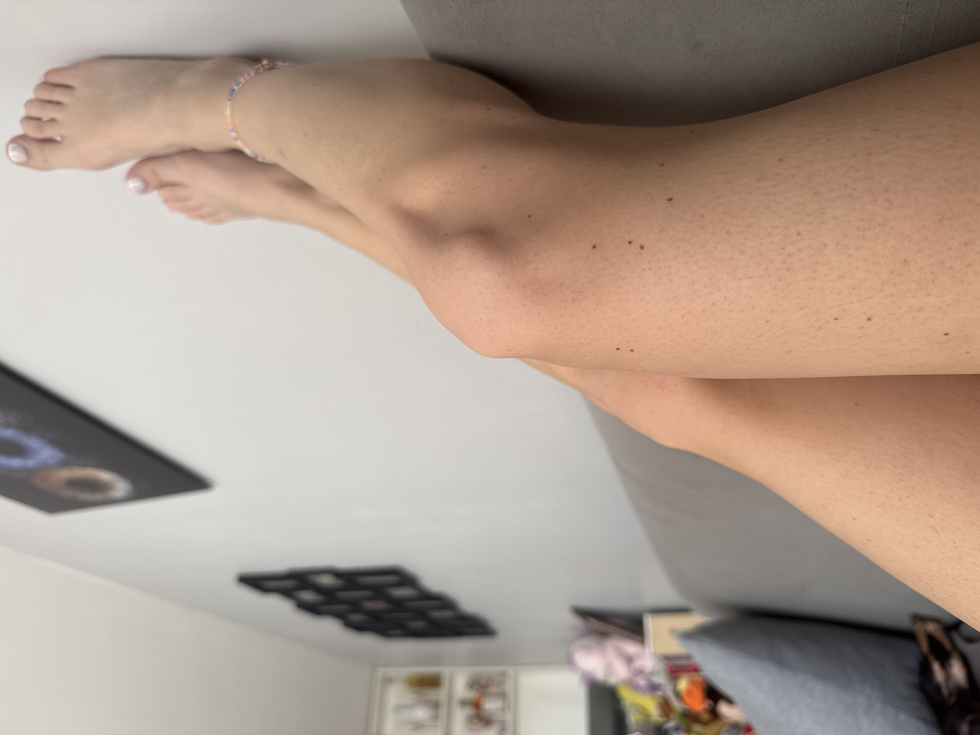 The image presents an upward-angled view of a person's lower legs and feet, elevated against a light-colored wall, within an interior residential setting in Plovdiv, Bulgaria. The subject's bare legs exhibit light-toned skin with visible hair follicles and multiple small, dark pigmented lesions (moles or freckles). Both knees are bent, and the feet are positioned above the knees. The toenails on both feet are painted with a light, reflective, possibly pearlescent polish. A multi-colored beaded anklet, primarily featuring pastel shades, is worn on the right ankle.
The legs appear to be resting on a gray upholstered surface, consistent with a couch or sofa, which occupies the lower portion of the frame. A blue-gray throw pillow is partially visible on the left side of this upholstered surface. A dark-colored animal, possibly a dog, is partially obscured in the bottom-left corner, positioned near the pillow and couch.
The background features a plain white or light gray wall. Mounted on the wall are two distinct sets of decorative items:
1. In the upper right quadrant, a large, dark-framed abstract artwork is visible, displaying blurred circular motifs in tones of blue, purple, orange, and brown.
2. In the mid-left quadrant, a grid-like arrangement of multiple smaller, dark-framed items, consistent with photographs or small prints, is affixed to the wall.
Further to the left, a white open shelving unit is partially visible, containing various blurred objects that appear to be bottles or decorative glassware. The environment suggests a relaxed domestic space.