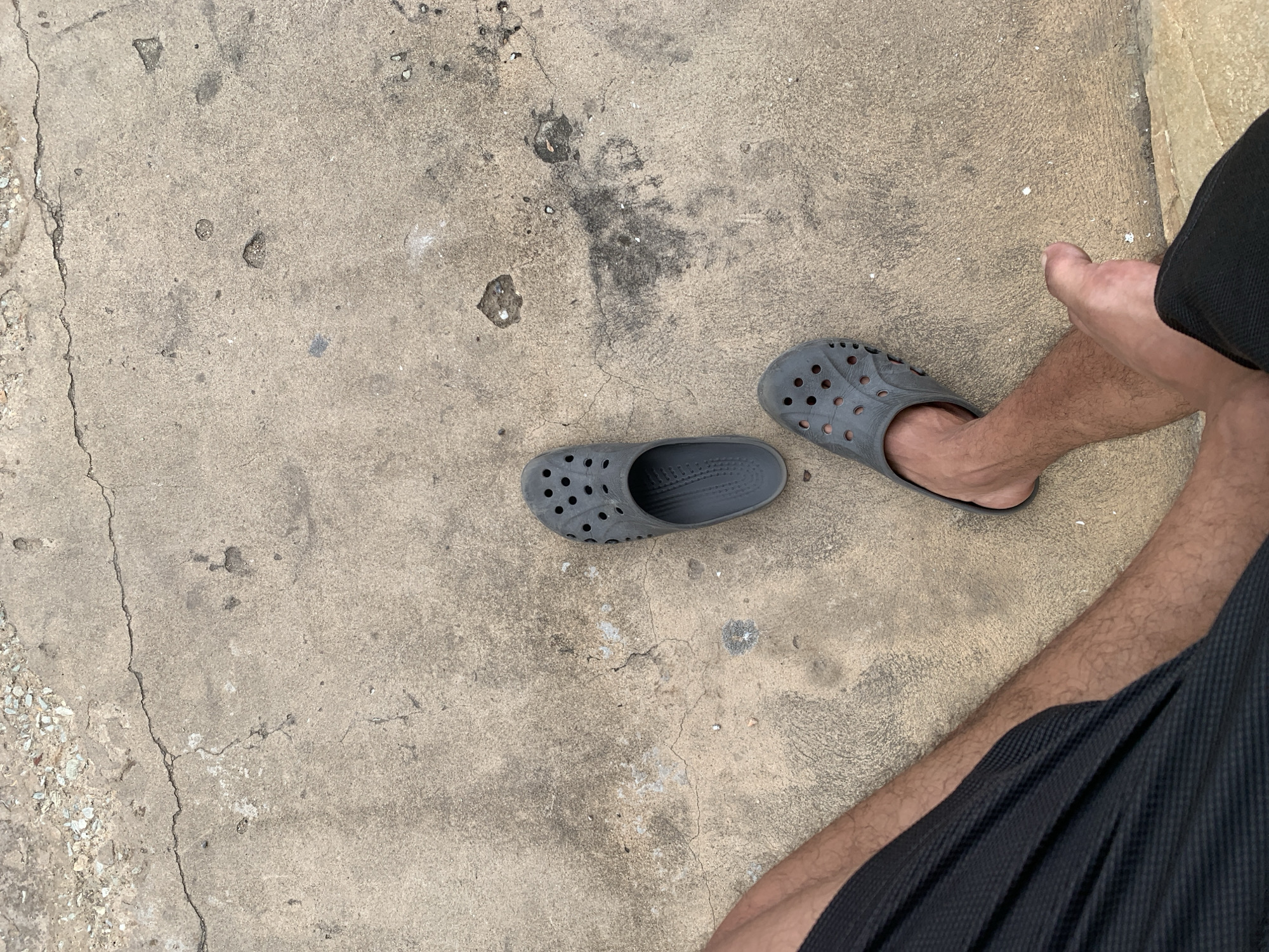 The image presents a top-down view of a person's lower legs and feet on a weathered concrete surface. The specific location in Santa Ana, Venezuela, is not discernible from the visual information provided.
In the bottom-left quadrant, the person's left bare leg and foot are visible, with the foot positioned next to an empty shoe. The leg is covered in short, dark hair. Dark, possibly black, textured shorts or pants are seen along the left edge of the frame.
Two dark grey, porous, slip-on shoes, similar in style to Crocs, are positioned on the concrete. The left shoe is empty, oriented upwards and slightly left of the image center. The right shoe contains the person's right foot and is oriented towards the bottom-right corner. The person's right bare ankle and lower leg are also visible.
The ground is a light gray concrete surface, exhibiting numerous fine cracks, larger fissures, chipped areas, and discolored patches, including darker smudges and lighter mineral deposits. Along the top edge of the frame, a distinct crack line separates the main concrete surface from a section containing small, light-colored pebbles and gravel. Scattered small white particles are visible on the concrete. The overall lighting is consistent with an outdoor, possibly overcast or shaded, environment.