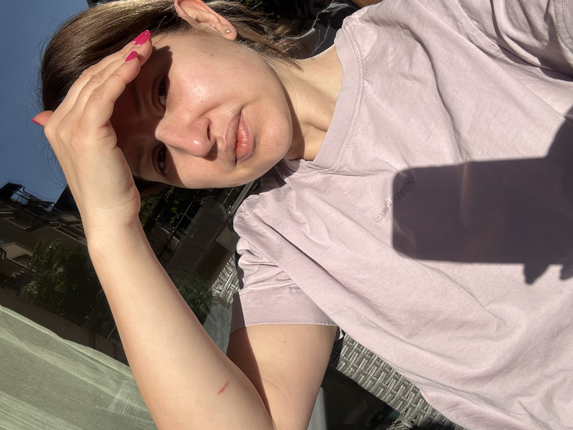 A woman with pink nails is posing in bright sunlight. She is shielding her eyes with her hand. She is wearing a light purple t-shirt. The environment appears to be an outdoor setting in Sofia, Bulgaria, evidenced by the architectural features visible in the background, possibly a balcony or terrace, and typical structures. The lighting suggests it is daytime. A small scrape can be seen on her left arm. The shadow on the woman's t-shirt is probably the result of a tree.