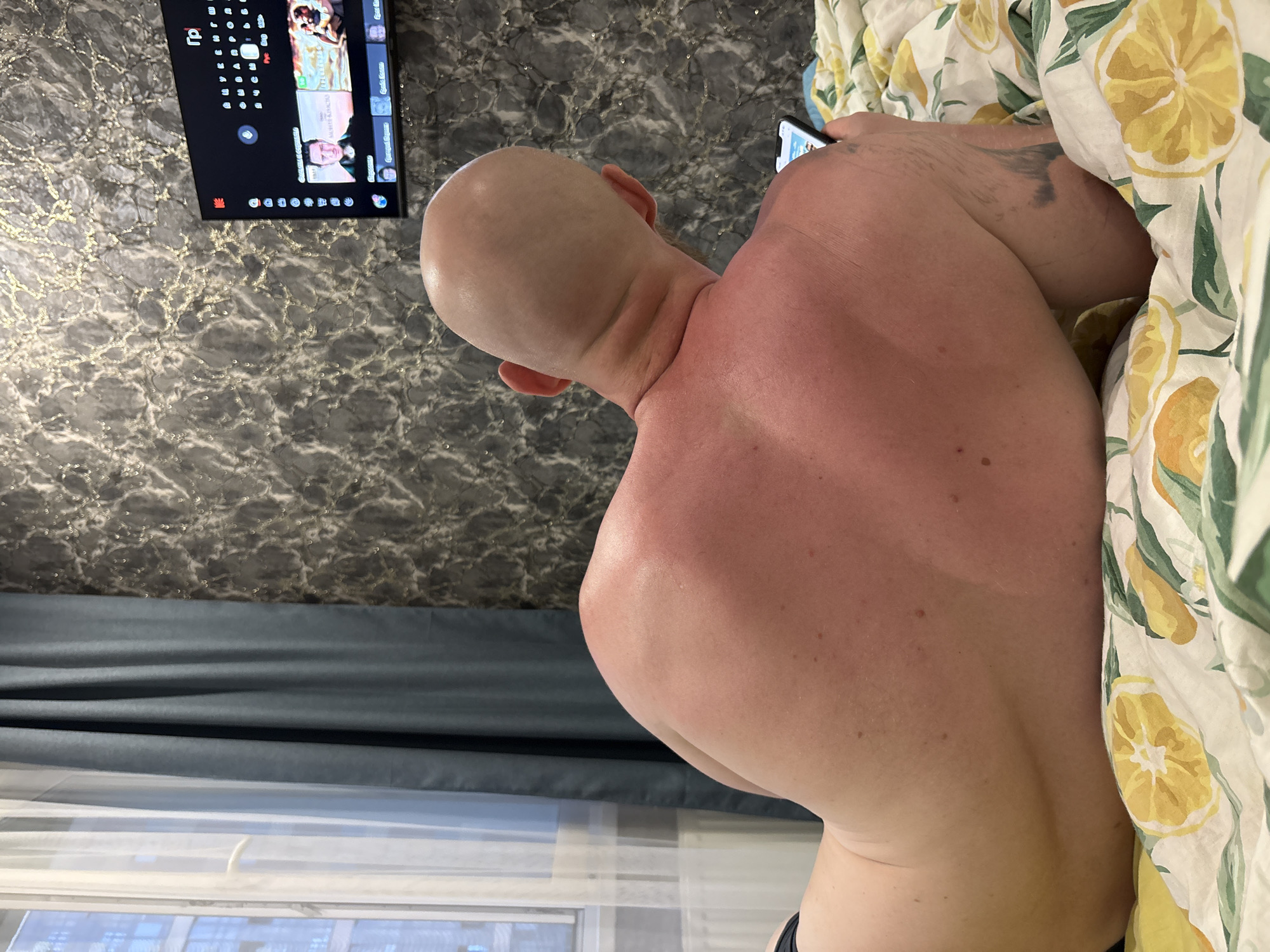 A partially unclothed, bald man lies on a bed with lemon-patterned sheets, holding a mobile phone. The man's back appears sunburned. A television is mounted on a wall with a marble-like pattern. A window with sheer and blue curtains reveals an exterior scene, possibly in Izhevsk, Russia.