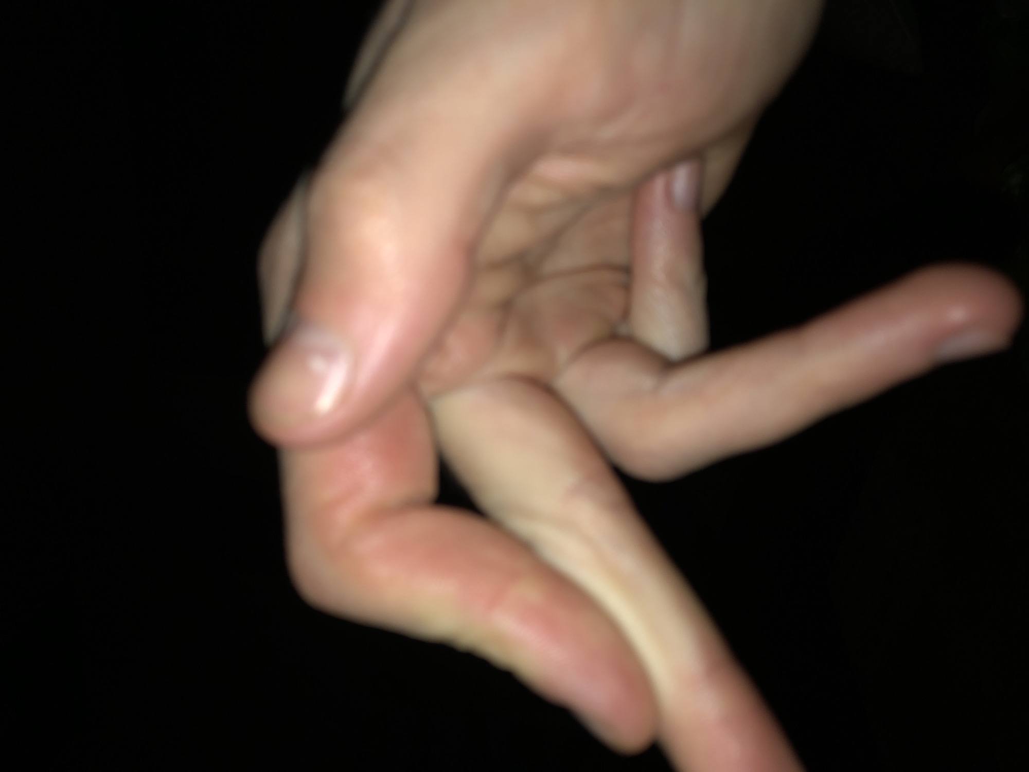 A right human hand is displayed against a black background. The fingers are bent, and the hand is viewed from a low angle. The skin appears light-toned, and the fingernails are short. The exact location and setting are indiscernible due to the limited context of the image.