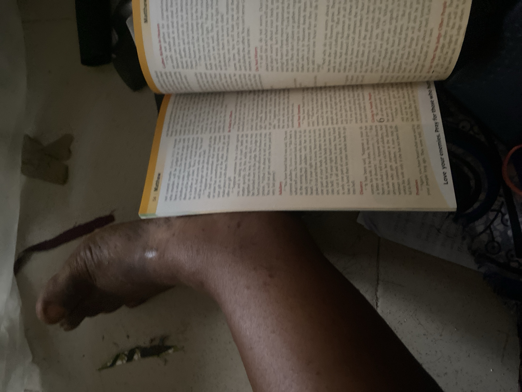 The image shows a close-up view of a person's leg and foot next to an open book. The book appears to be a Bible, with text visible on both pages. The leg is dark-skinned and appears to have some swelling. The environment is dimly lit, with some items on the floor that are difficult to discern. The scene is indoor. The image does not contain information that can identify the location in the city of Jauro Yinu, Nigeria.