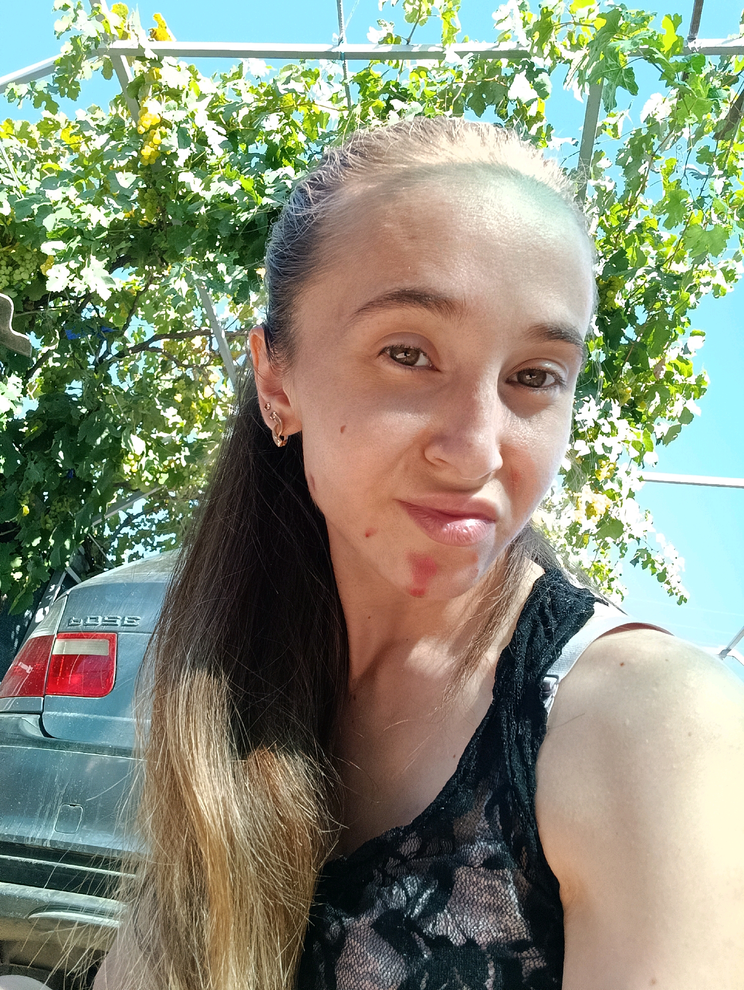 The image shows a young woman in a selfie, taken outdoors. She is looking at the camera with a slight pout. Her hair is long and brown, with some lighter streaks. She is wearing a black lace top. Her face has some blemishes on her chin and lips. In the background, there is a car, some greenery, and a clear blue sky. The scene appears to be in a residential area, possibly in a rural setting, with a car parked and a vine-covered structure suggesting an outdoor living space. The lighting indicates it is daytime. The user states the location is Vypasne, Ukraine, but this cannot be verified from the image alone.