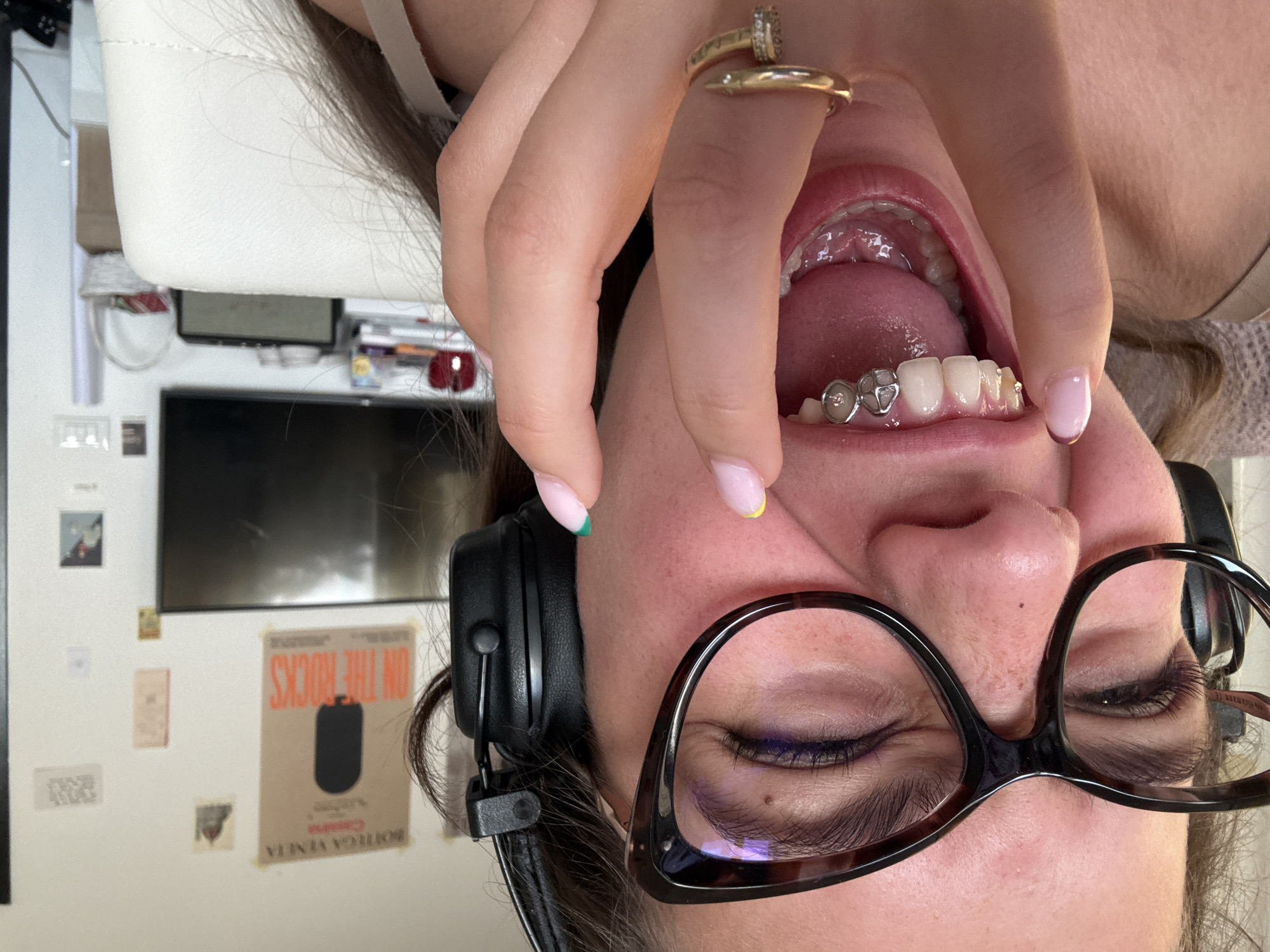 A person is shown in an upside-down selfie, wearing eyeglasses, headphones, and a gold ring. They are pulling their upper lip up to expose their teeth, which have braces and retainers. The background includes a television, a poster reading "ON THE ROCKS," and some other wall decorations. The city of Milan, Italy, is not discernible from the image.