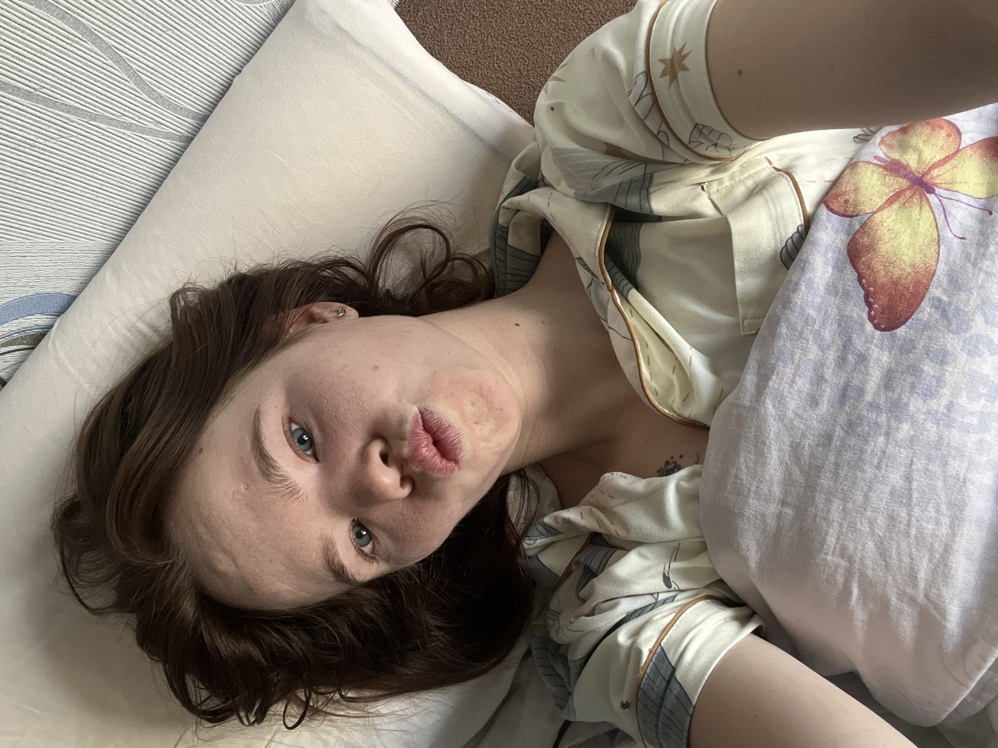 A woman is depicted lying in bed, taking a selfie from an overhead perspective. Her head is positioned on a plain white pillow, with her dark brown hair spread out. She has blue eyes and fair skin, looking directly at the camera with her lips pursed in a "kiss" or pout. A circular red mark is visible on her left cheek. She is wearing light-colored pajamas with a subtle pattern featuring stars and abstract designs, accented with brown piping. A small, silver hoop earring can be seen in her left ear. Partially covering her body is a blanket or bed sheet with a large, colorful butterfly print in shades of yellow and orange. The background includes a patterned headboard or wall, featuring light-colored diagonal stripes. The overall scene conveys a relaxed indoor setting, likely a bedroom, in Chaikovsky, Russia. There is no visible text.