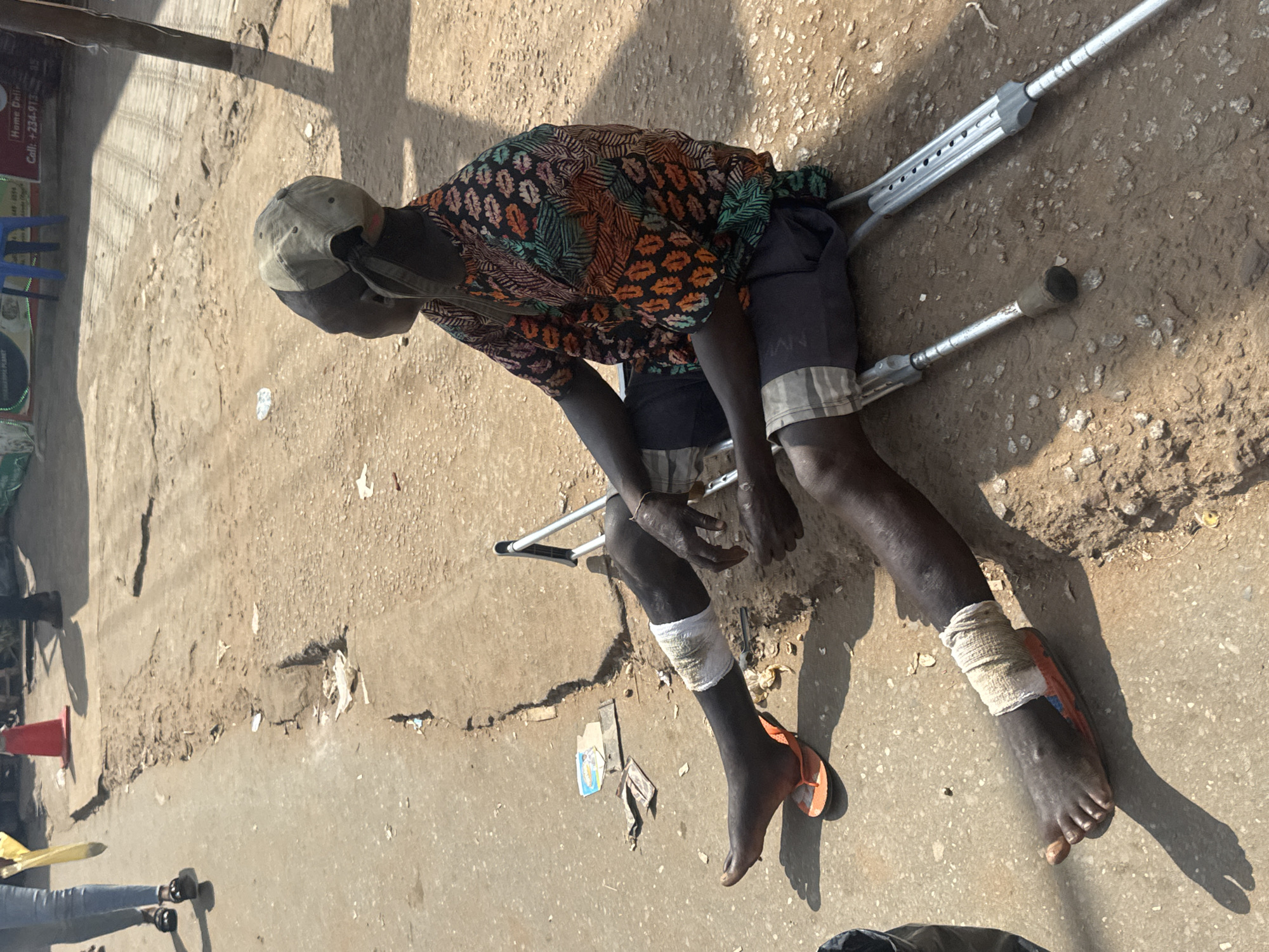 A man with bandages on both legs and wearing a cap is sitting on a dirt road next to crutches in Nkpor, Nigeria. He is wearing a colorful, patterned shirt and checkered shorts. The road is cracked and uneven, with debris scattered around. In the background, a traffic cone and people walking can be seen.
