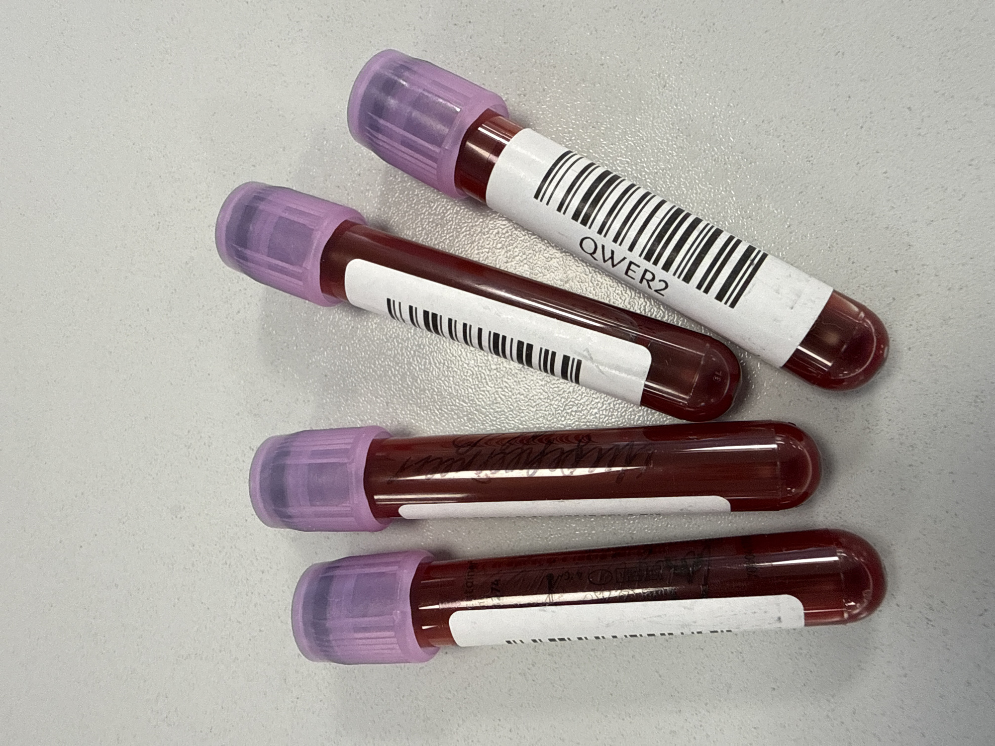 The image shows four blood sample collection tubes with purple tops lying on a light gray, lightly textured surface. The tubes are partially filled with a dark red liquid, presumably blood. Two of the tubes have printed labels with a barcode and the alphanumeric string "QWER2". The other two tubes have labels with illegible handwritten text in black ink. The environment appears to be a laboratory or medical setting. The location is not identifiable from the image.
