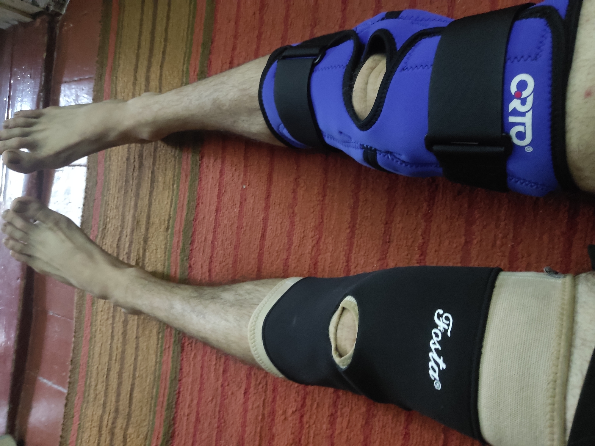 The image shows a pair of human legs lying on a striped surface. One leg is fitted with a blue knee brace with black straps bearing the "CRTO" logo. The other leg has a black knee brace with a beige band and the word "Fosta" printed on it. The scene appears to be indoors. The location is Unknown, Unknown.