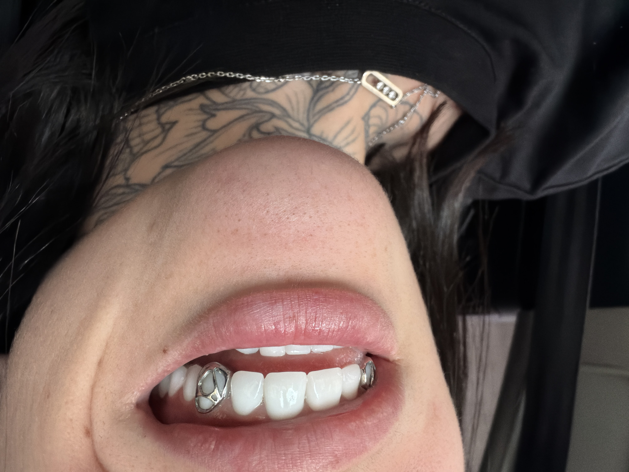 A close-up, inverted perspective photograph features a person's mouth with prominent upper teeth. The teeth are uniformly white and appear to have decorative metal caps on the canines. The person has full lips. Above the mouth, the image extends up to the lower part of the face, including the nose. The person also appears to have a tattoo on their upper chest or neck, visible behind the face. A silver necklace is visible as well. The background is dark and less defined, indicating an indoor setting with black clothing. There is no explicit indication of a location in Sofia, Bulgaria in this image.
