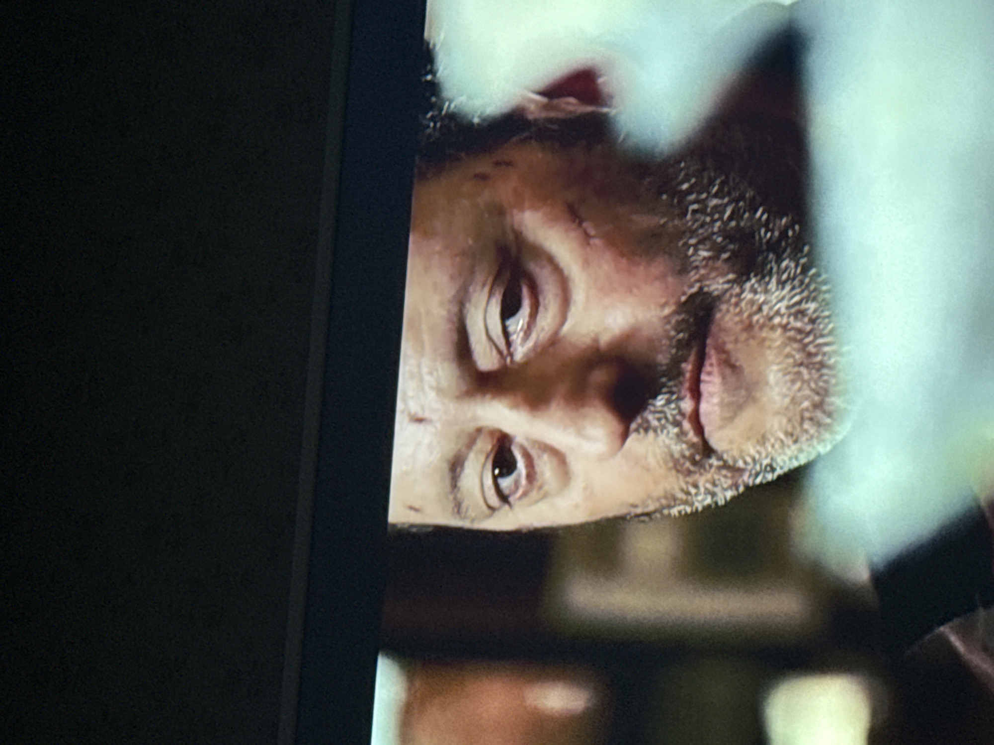 The image shows a close-up of a man's face with a beard, likely viewed on a television screen. The man has some abrasions on his face near his left temple. The screen is partially obscured by the edge of a dark object, possibly the television frame itself. The background behind the man appears to be blurred, suggesting shallow depth of field or the resolution of the image on the screen. There is no information available to determine the location is Mytishchi, Russia.