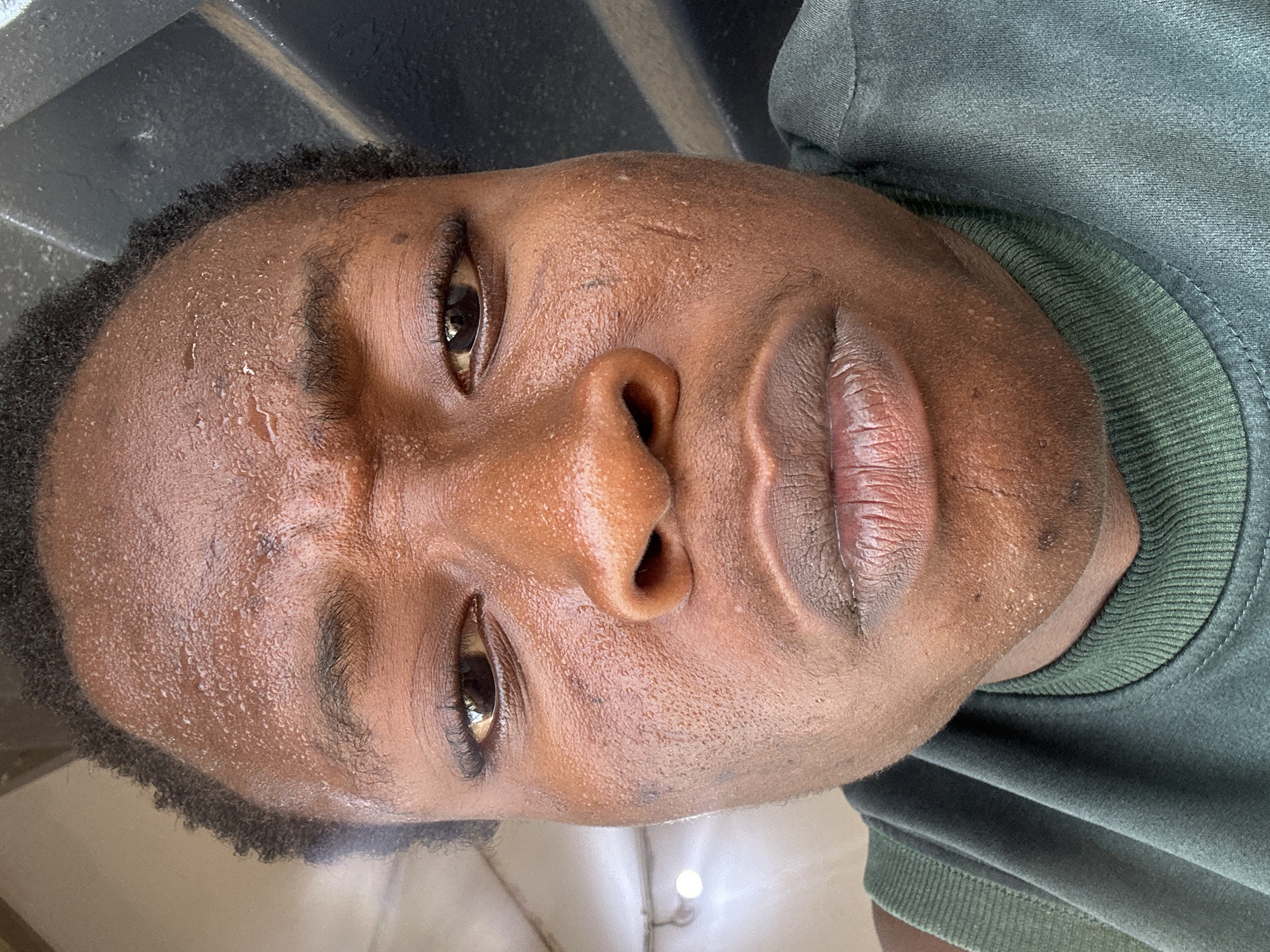 A close-up, slightly angled photograph depicts a person's face. The individual has dark skin, short dark hair, and is wearing a green crew neck shirt. Beads of sweat are visible on the forehead. There is a small scar above the left eyebrow. The location is Unknown, Unknown.
