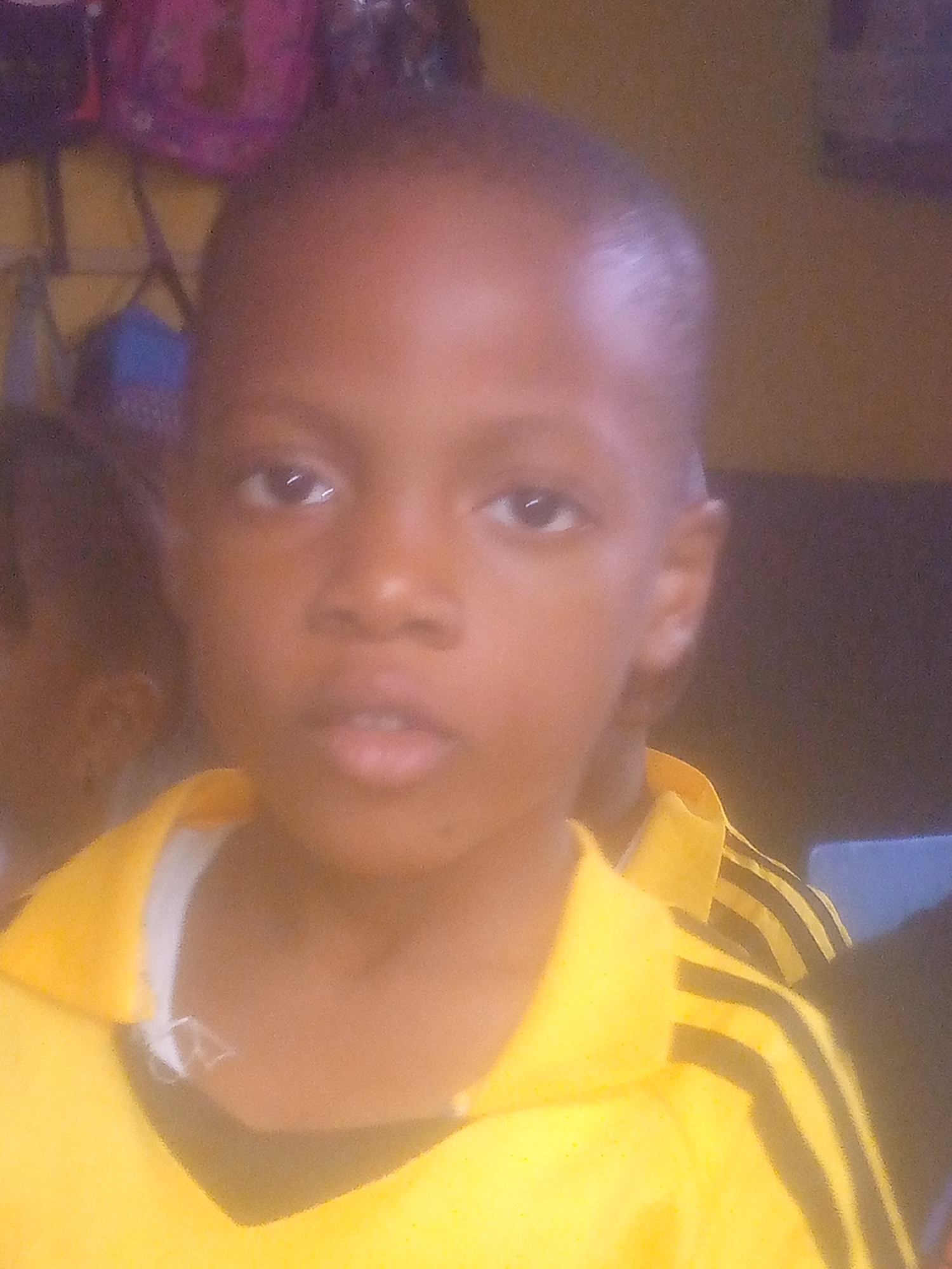 A close-up shot shows a child with brown skin, dark eyes, and a shaved head. The child is wearing a yellow shirt with black stripes on the shoulder. The location is unidentified. The city is unsubstantiated. A partial image of another child’s face is to the left. A chair and other objects are visible in the blurred background.