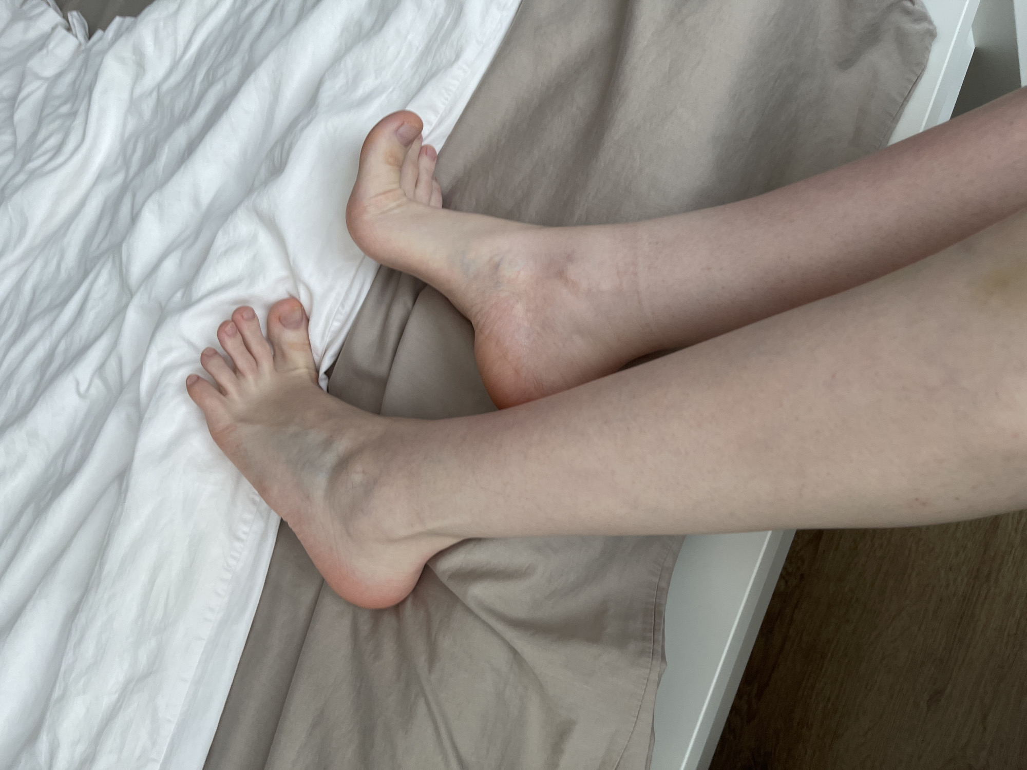 The image shows a close-up, overhead view of a person's legs and feet lying on a bed. The bedding is composed of white wrinkled sheets on the left and beige fabric on the right. The person's skin is fair, and their legs appear slightly pale, with some minor blemishes visible. The feet are positioned on the white sheets, with toes spread. The lighting suggests it is daytime, but there are no specific clues about the time of day or weather. The scene appears to be a bedroom setting. No text is visible in the image. The overall impression is one of a quiet, private moment.