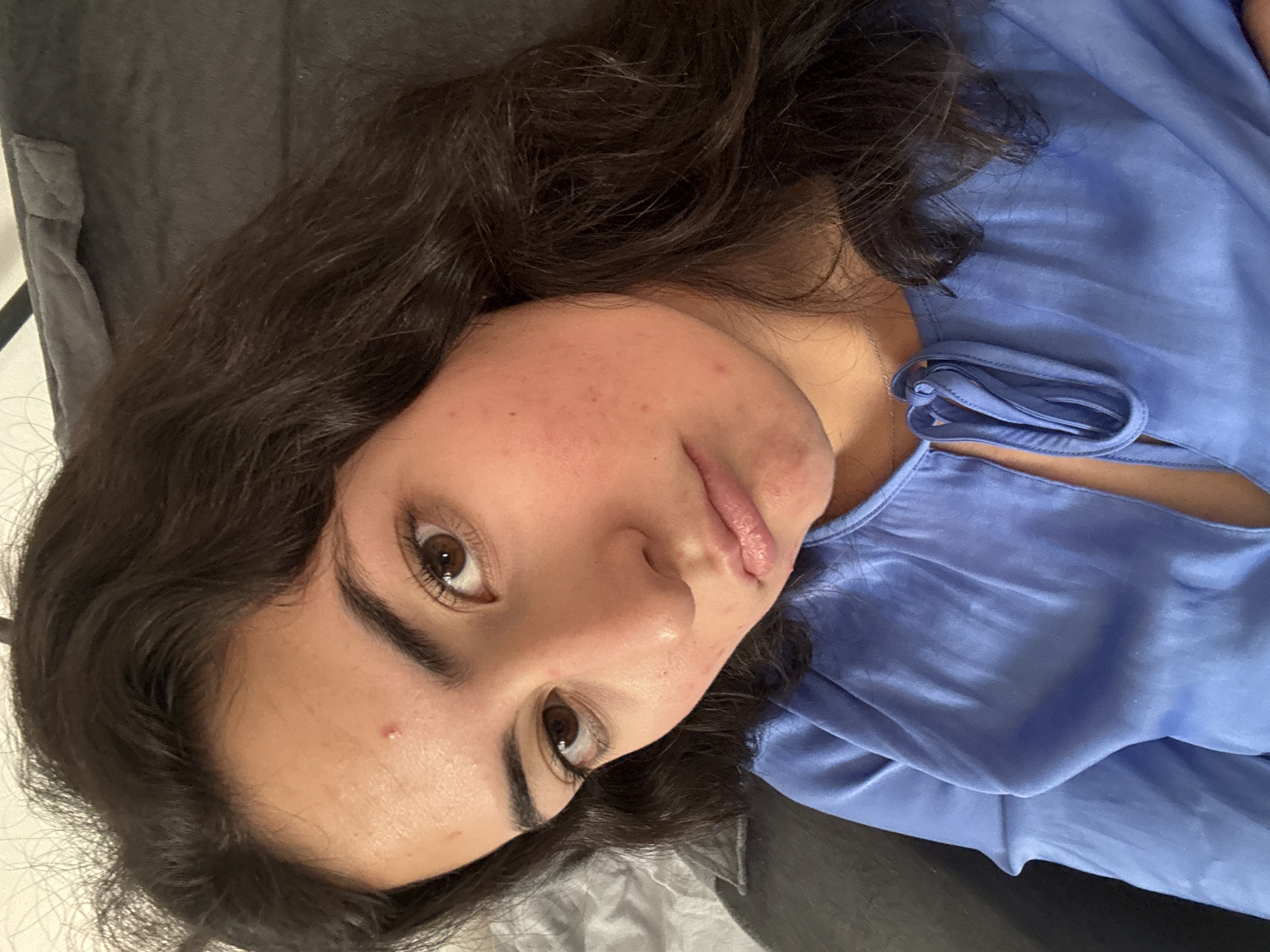 A young woman with brown curly hair and fair skin is lying on a gray surface. She is wearing a blue satin top. Her face is turned towards the camera, showing brown eyes and slight acne. The background is a gray surface, possibly a bed or couch. The location is unknown and cannot be determined to be Puebla, Mexico, from the image.