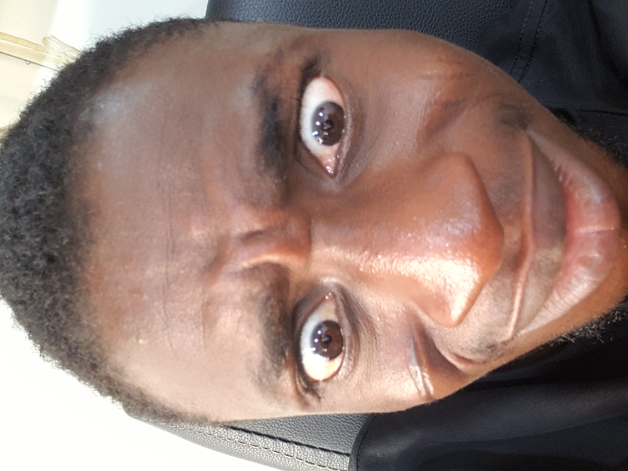 A close-up, rotated portrait features a Black individual with dark skin, positioned in what appears to be Adankolo, Nigeria. The person is looking directly at the camera with an exaggerated expression, characterized by widely opened brown eyes and an open mouth, possibly conveying surprise, playfulness, or humor. Reflections of a light source are visible in both pupils.
The individual has short, dark, and curly hair around the hairline. Their skin shows a noticeable sheen, particularly on the forehead, nose, and cheeks, suggesting sweat or oiliness. The background is simple: a light, undefined area on the left side, and a dark, textured surface, possibly a leather car seat or chair, on the right and behind the head. The person is wearing a dark, possibly black, collared garment. No text is visible in the image.