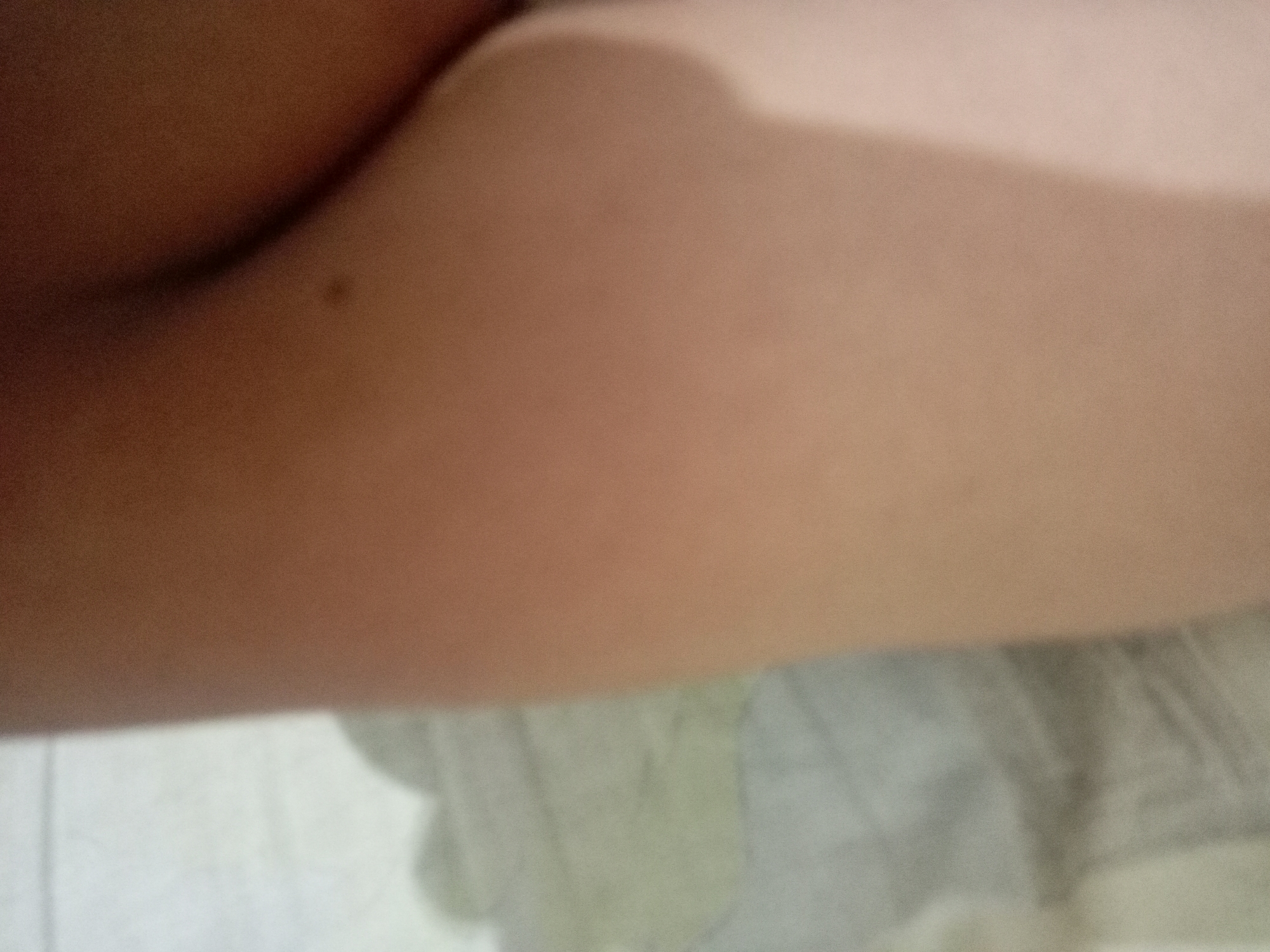 The image is a close-up, blurry shot of a person's arm, likely a portion of the upper arm. The skin tone is light brown, with some subtle variations in color due to lighting. A dark mole is visible on the arm, slightly to the left of the center. The background is out of focus, showing a textured surface that appears to be fabric, possibly bedding or a blanket, in muted tones of white and light gray, with some vertical lines suggesting folds or seams. The lighting is soft and diffused, casting gentle shadows and highlighting the contours of the arm. There is no indication of the specific location within Batam, Indonesia, as the image focuses solely on the personal subject matter.