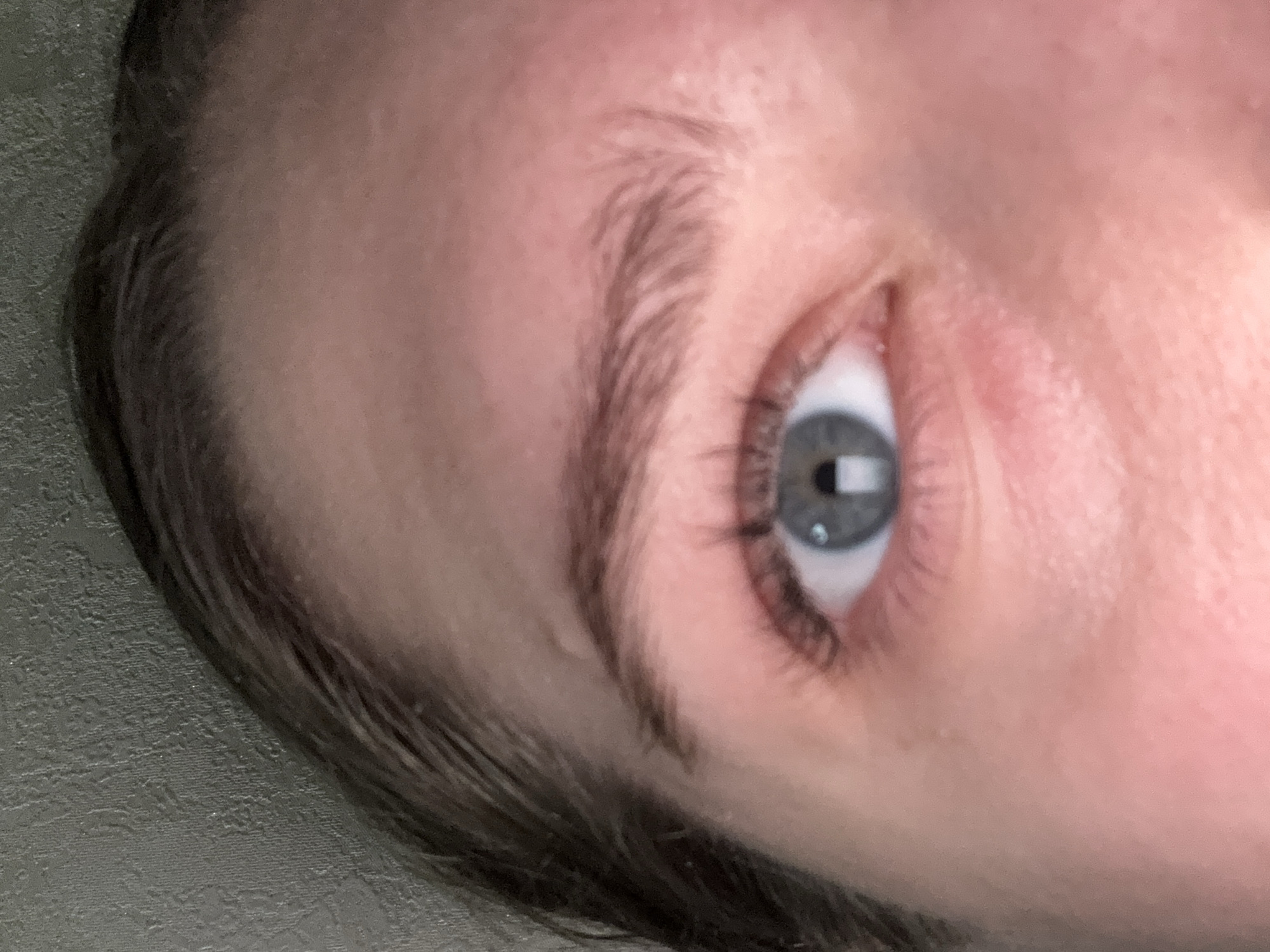 The image is a close-up, low-angle shot of a person's left eye and surrounding facial features. The skin appears fair with some redness, and there are visible eyelashes. The iris of the eye is light blue with a darker pupil. The eyebrow above the eye is dark and somewhat sparse. The background is a textured, grayish surface, possibly wallpaper or a wall. The image does not provide any information about the location in Saratov, Russia, or any specific context beyond the visual details of the eye and face.