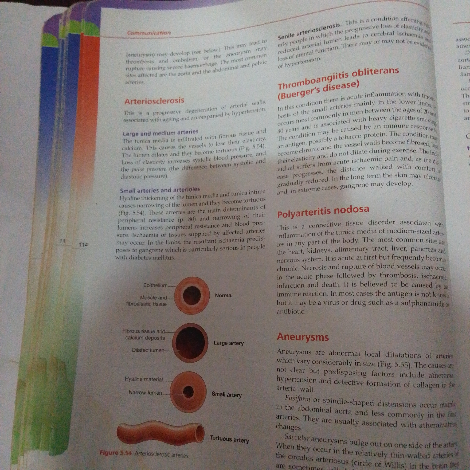 The image shows a page from a textbook with medical information about arteries and blood vessels. There are several sections of text discussing conditions like arteriosclerosis, thromboangiitis obliterans, polyarteritis nodosa, and aneurysms. There are also three diagrams illustrating different types of arteries (normal, large artery, small artery) and a diagram of a tortuous artery. The text is in English. There is no information in the image that relates to Jalingo, Nigeria.