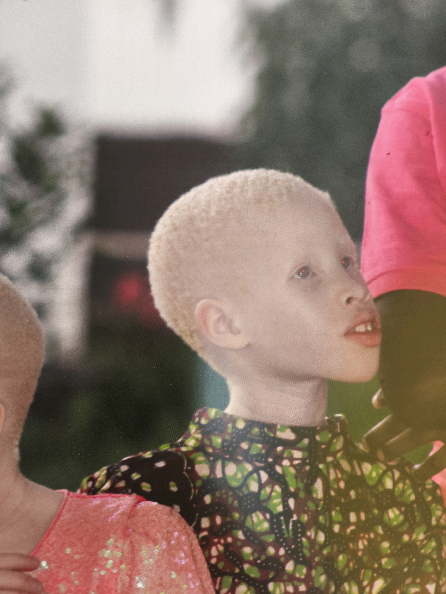 A close-up, medium shot captures a young boy with albinism, his head turned to the right in profile. His skin is very pale, and his hair is a light blonde. He wears a dark green shirt with a repeating pattern of lighter green and black abstract shapes. To his left, another child, only partially visible, wears a bright pink, sequined dress. Behind the boy with albinism, a person in a bright pink garment is visible, and a dark hand is resting on the boy's shoulder. The background is softly blurred, suggesting an outdoor setting with greenery and some indistinct structures. There is no discernible indication of the location being Passignano sul Trasimeno, Italy.