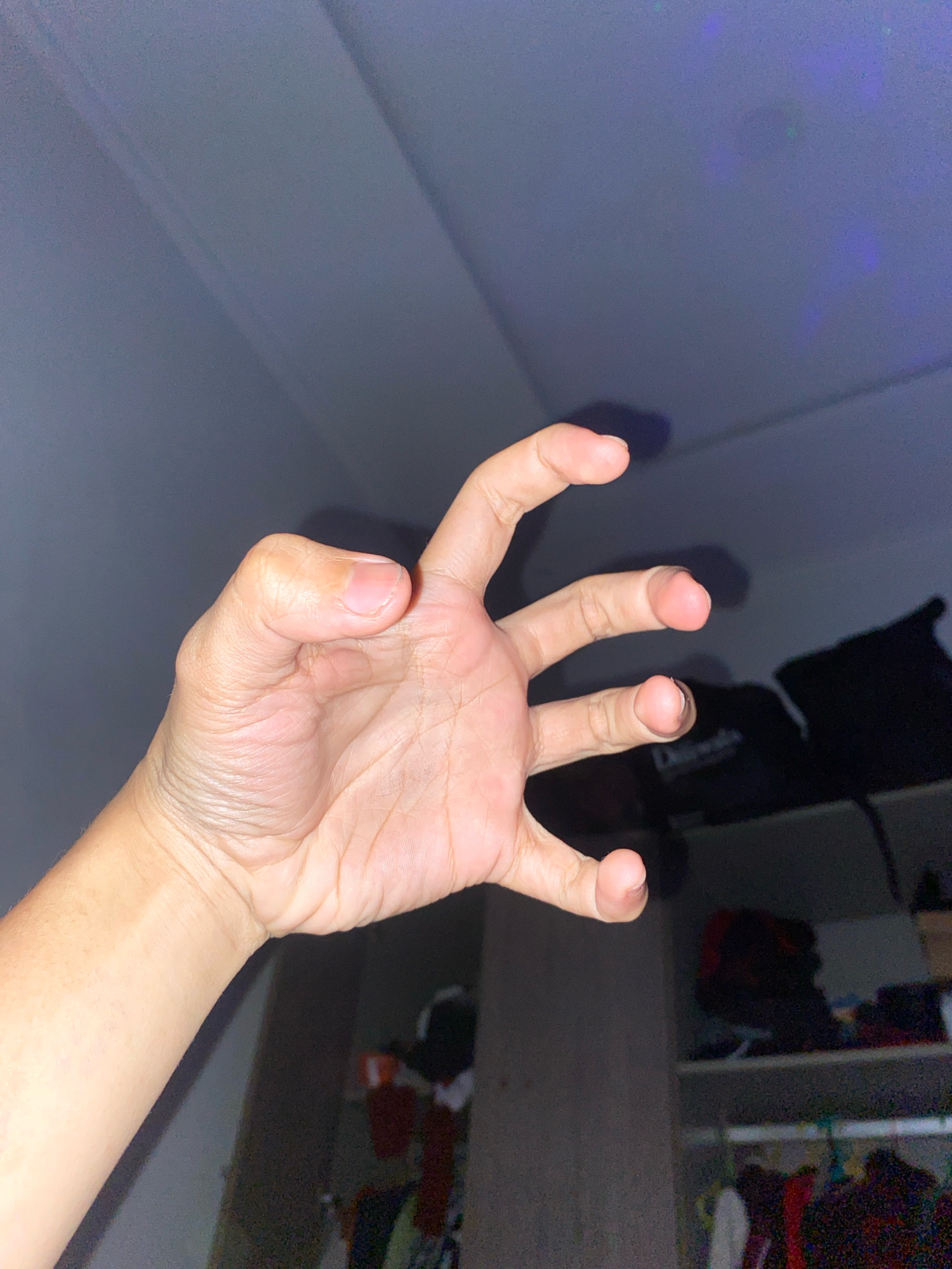The image shows a close-up of a human hand with its fingers curled, resembling a claw-like gesture. The hand is positioned in the foreground, with the palm facing the viewer. The background is dark and out of focus, showing what appears to be a room with shelves and some indistinct objects, possibly clothing or bags. The lighting is dim, with some faint blue and green lights visible in the upper right corner. There is no indication of the location being Klurak, Indonesia; this information seems to be extraneous to the visual content of the image.