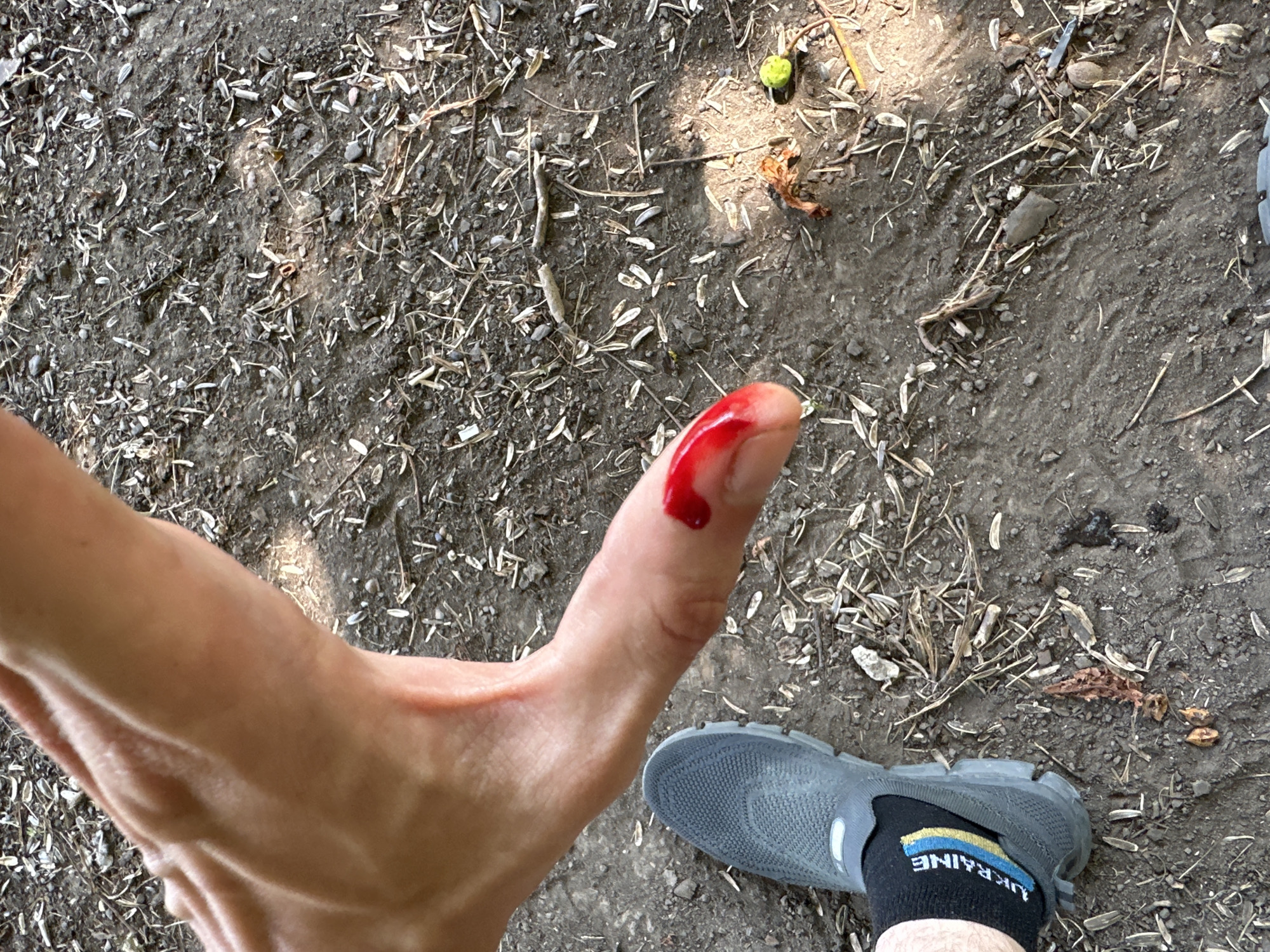 The image shows a close-up view of a person's thumb with blood on the tip, lying on the ground. The ground appears to be dirt with scattered debris such as dried leaves, twigs, and seeds. A grey athletic shoe with a black sock featuring a Ukrainian flag design is visible in the lower left corner. The lighting suggests it is daytime. There is no information in the image to indicate the specific location within the city of Makiv, Ukraine, or the circumstances of the injury.