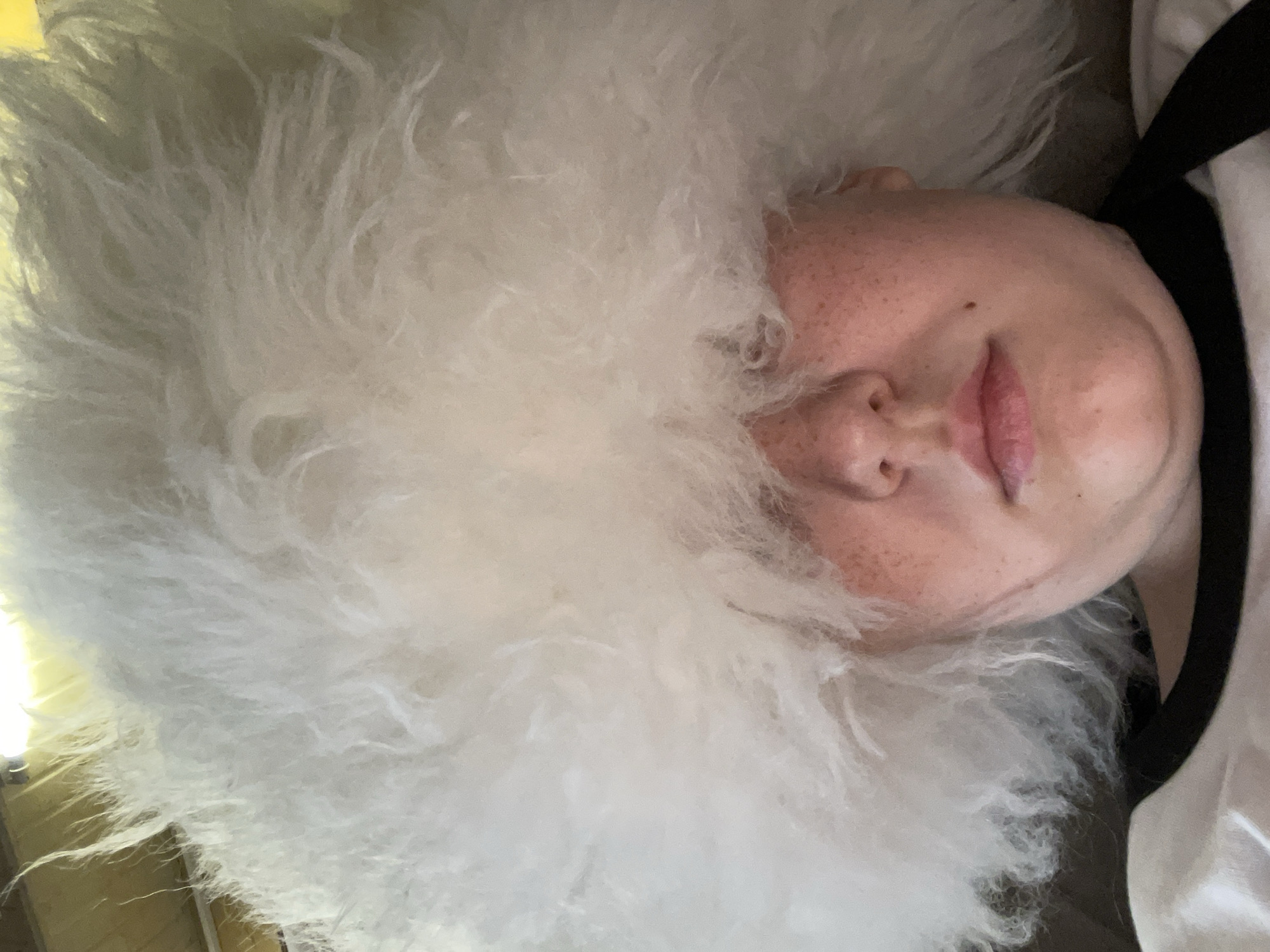 The scene depicts a frontal, close-up view of one individual indoors, located in the city of Unknown, Unknown. The person's face is partially visible, with a prominent amount of voluminous, white, shaggy material covering their head and obscuring their eyes and forehead. Visible facial features include a nose, closed lips, and a chin exhibiting a slight double chin. The skin tone is fair with numerous light reddish-brown freckles visible across the nose and cheeks. The person appears to be wearing a white garment with a black collar or trim visible around the neck. The background is minimally visible, showing a light-colored ceiling or wall and what appears to be a light fixture in the upper left corner. The individual is looking directly towards the camera.
