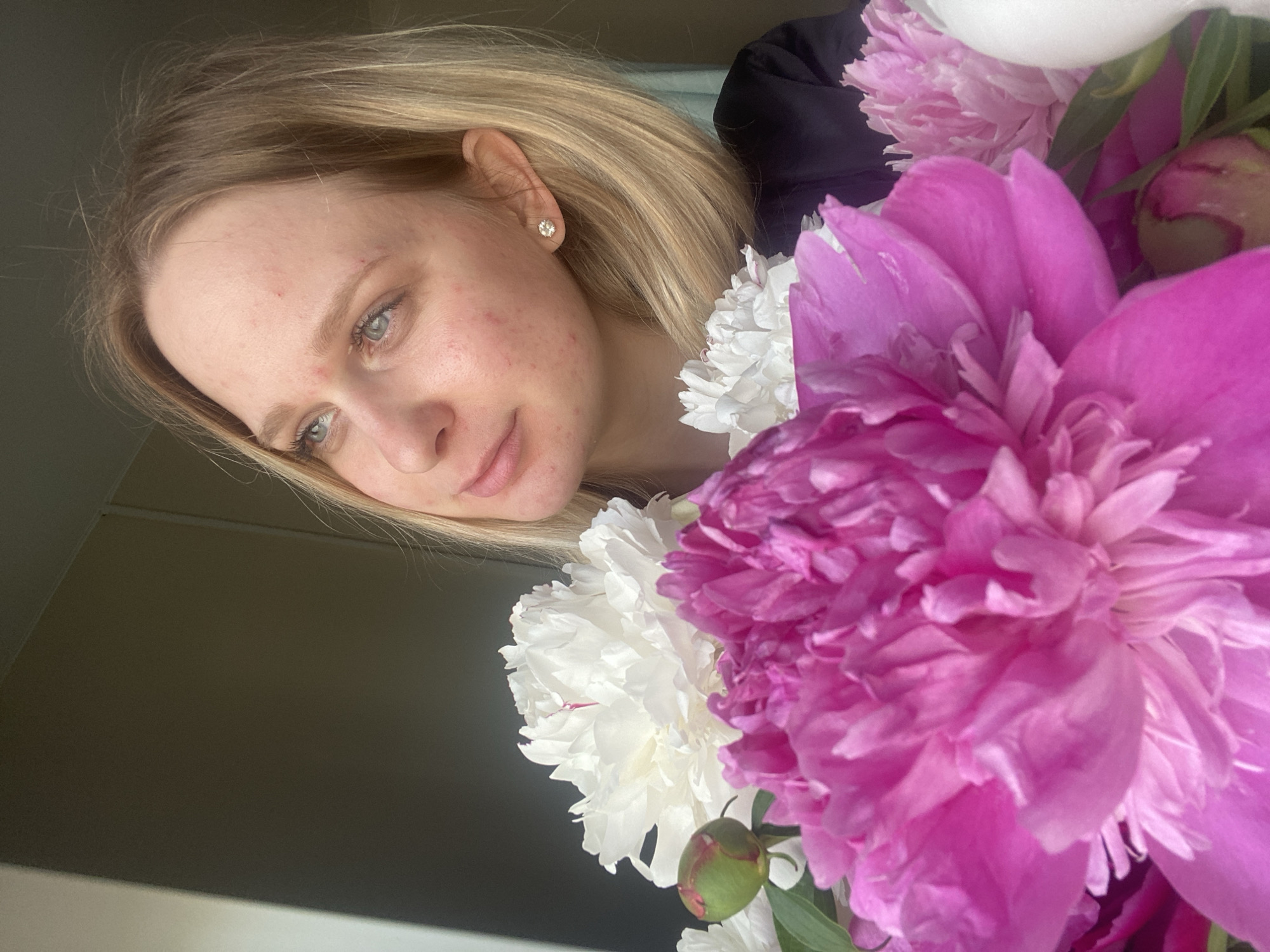 The image depicts a close-up, waist-up view of a young adult female holding a large bouquet of peonies indoors, in the city of Unknown, Unknown. The female, with shoulder-length blonde hair parted on her left side, has light-colored eyes (blue/grey) and fair skin exhibiting several small red blemishes across her forehead, cheeks, and chin. Her expression is gentle, with her gaze directed upwards and to her left. She is wearing a dark, possibly satin or silk, garment. A single stud earring, appearing to be a clear stone, is visible in her left ear.
The prominent foreground and lower-left portion of the frame are filled with the flowers. The bouquet consists primarily of large, fully bloomed peonies. In the immediate foreground, there are multiple vibrant magenta/bright pink peonies. Behind these, and to the left, are several white peonies, one of which shows a faint reddish streak on a petal. A single green peony bud is visible on the far left, accompanied by some green foliage.
The background is an indistinct, dark gray/brown wall, suggesting an indoor setting. To the far left, a narrow vertical strip of lighter, possibly white, wall or window frame is visible. The lighting appears to be natural, emanating from the left, illuminating the woman's face and the flowers. No specific city or geographical markers are present in the scene.