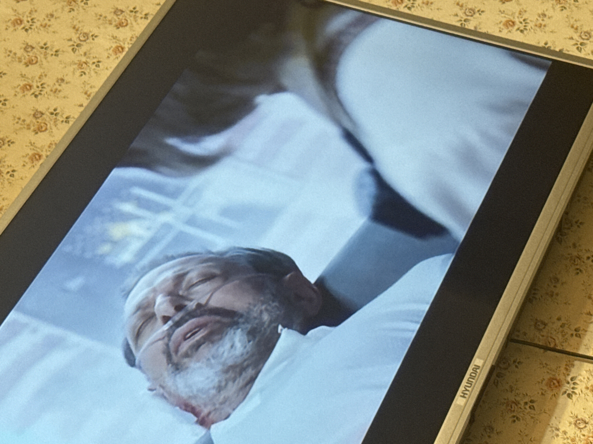 A television screen displaying a scene of a man in a hospital bed. He is lying on white sheets, with a nasal cannula in place. His eyes are closed and he has a grey beard. The television has the "HYUNDAI" logo on the lower right frame. The television is on a surface with a floral pattern. The image lacks sufficient geographical or contextual information to determine if it is in Mytishchi, Russia.