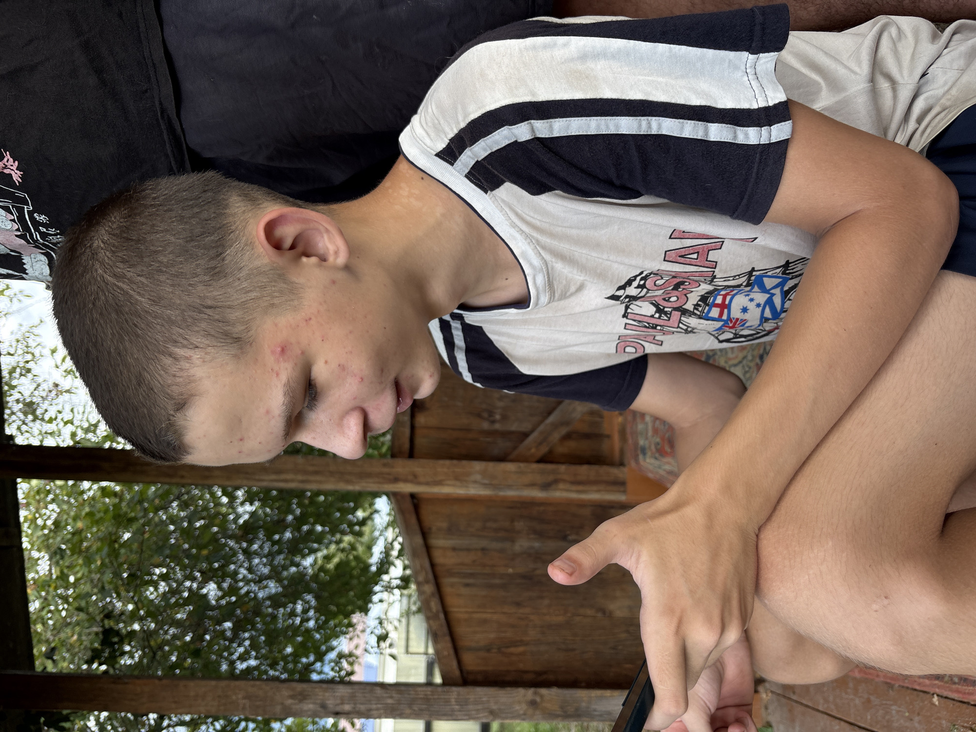 The image shows a young person, likely a boy, sitting outdoors and looking at a smartphone. The person has short brown hair and appears to have some acne on their face. They are wearing a t-shirt with a striped design on the sleeves and neckline, and the shirt has a graphic print on the front. The background suggests a rustic setting, with wooden structures and greenery visible, possibly a porch or a wooden shed in a backyard. The lighting indicates it is daytime. The person is holding a smartphone in their hands, and their gaze is directed downwards towards the screen, suggesting they are engaged with the device. The overall mood appears relaxed and casual. There is no visible text in the image.