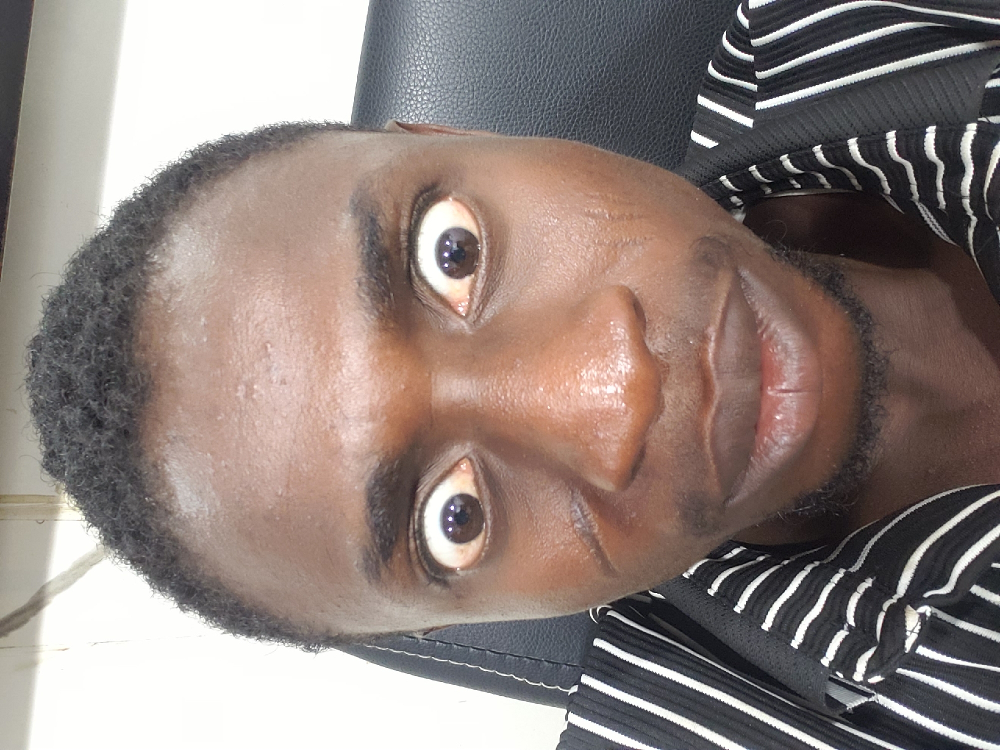 A close-up, rotated portrait captures a young individual with dark skin, positioned indoors in what appears to be Adankolo, Nigeria. The person gazes directly into the camera with wide-open eyes, conveying a sense of intensity or surprise, and a faint smile plays on their lips. They have short, dark, tightly curled hair and visible dark stubble on their chin and jawline. Their skin has a slight sheen, possibly due to natural oils or lighting. The individual is wearing a black and white striped shirt, with the collar visible around their neck. Behind them, part of a black, possibly leather, chair headrest is visible, along with a bright white background, suggesting an indoor wall or window. The lighting is bright and even, indicating daytime. No visible text is present in the image.